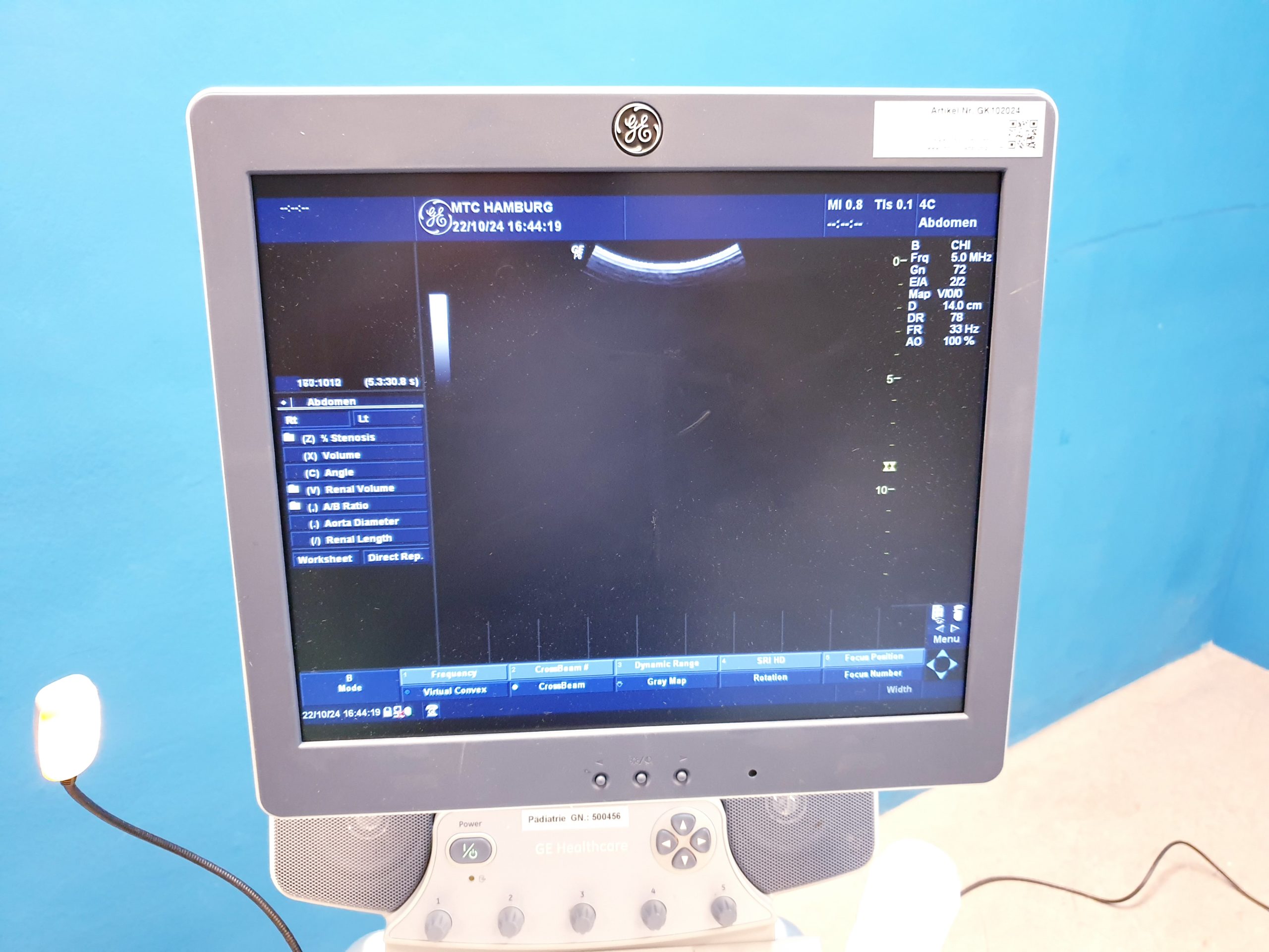 GE LOGIQ P6 Pro +4C+11 + 7S – Kardiomaschine – Bild 21