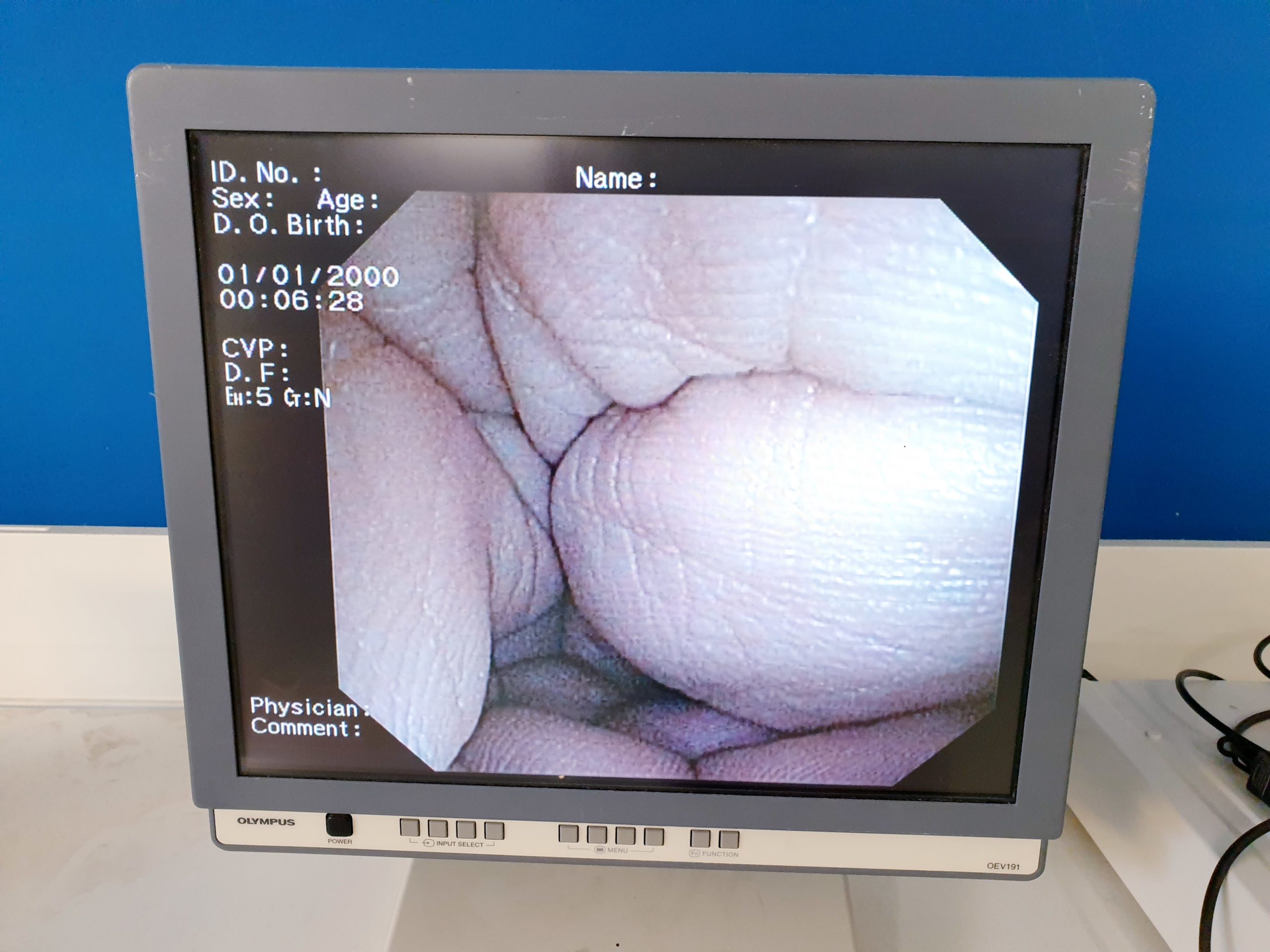 Olympus CV-160, CLV160 + MAJ-843 - Endoskopie System – Bild 13