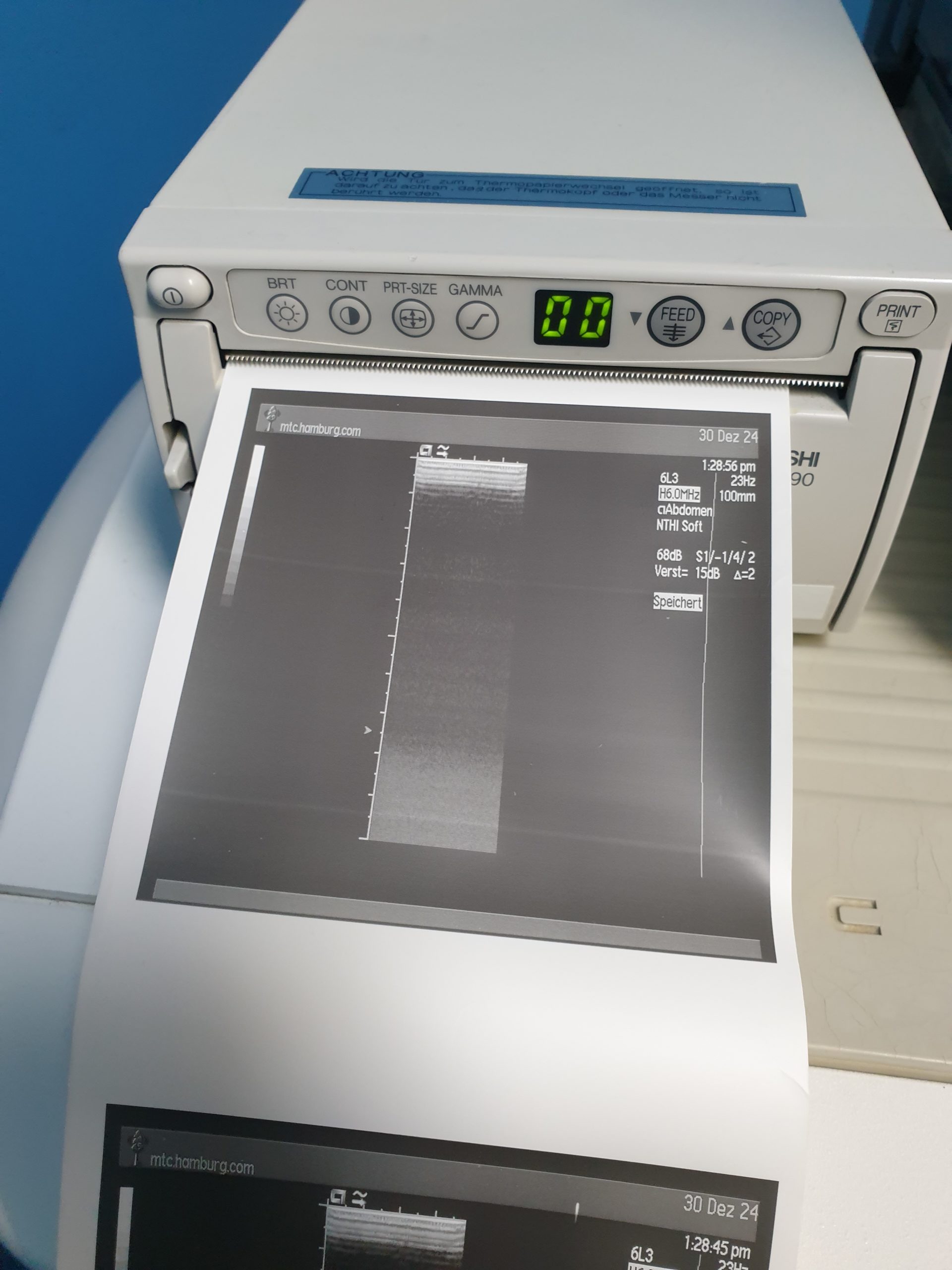 Siemens Acuson Sequoia 512 Farbdoppler + 4V1c + 4C1 + 6L3 – Bild 10