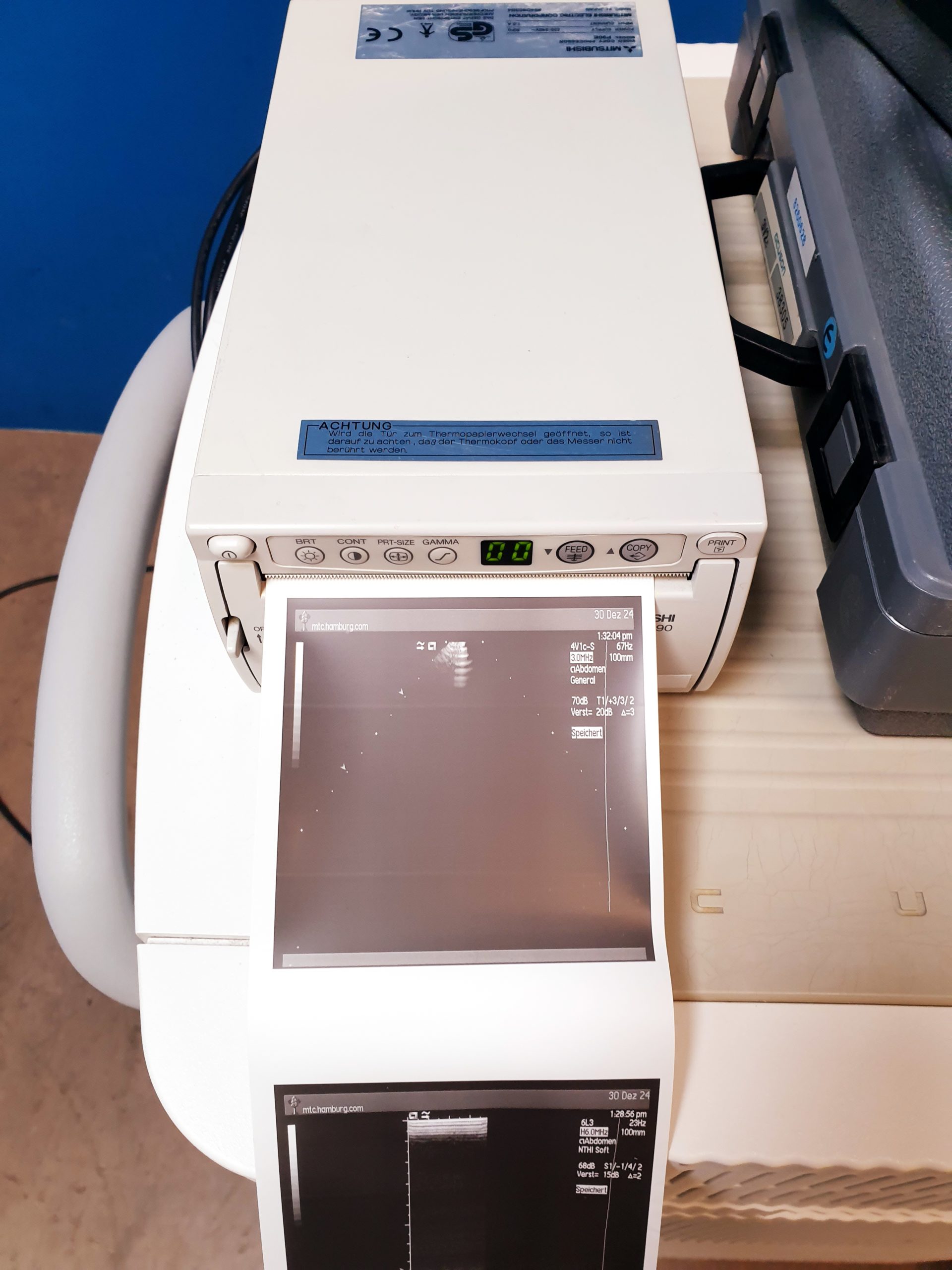 Siemens Acuson Sequoia 512 Farbdoppler + 4V1c + 4C1 + 6L3 – Bild 17