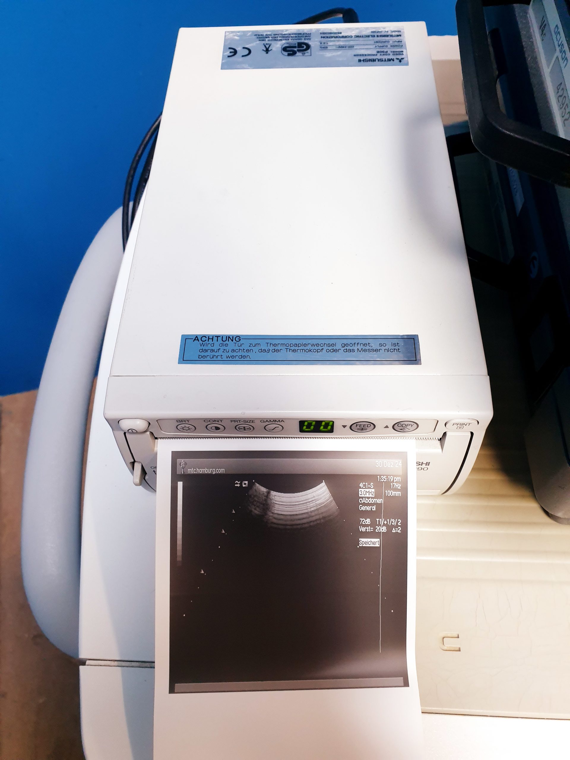 Siemens Acuson Sequoia 512 Farbdoppler + 4V1c + 4C1 + 6L3 – Bild 25