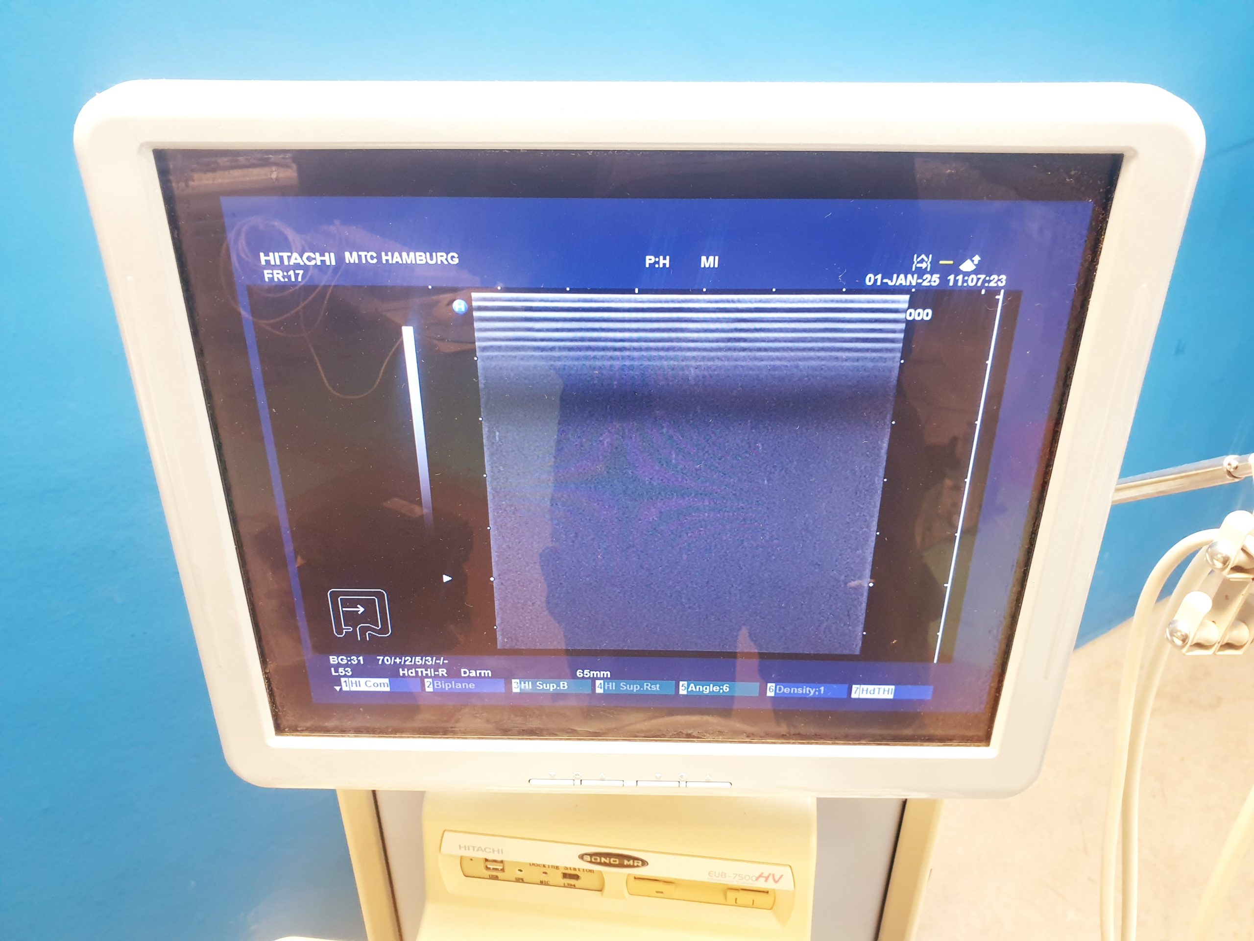 Hitachi EUP-L53 Lineare Sonde – Bild 5