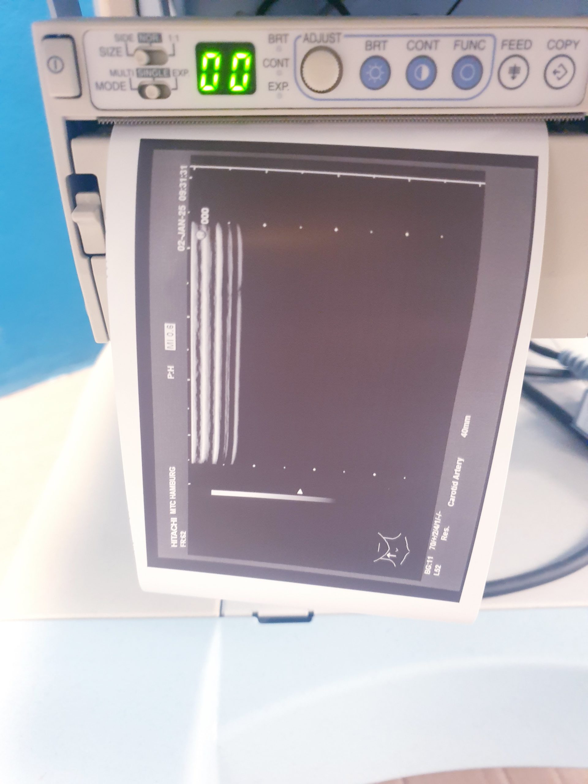 Hitachi EUP-L52 Lineal Sonde – Bild 4