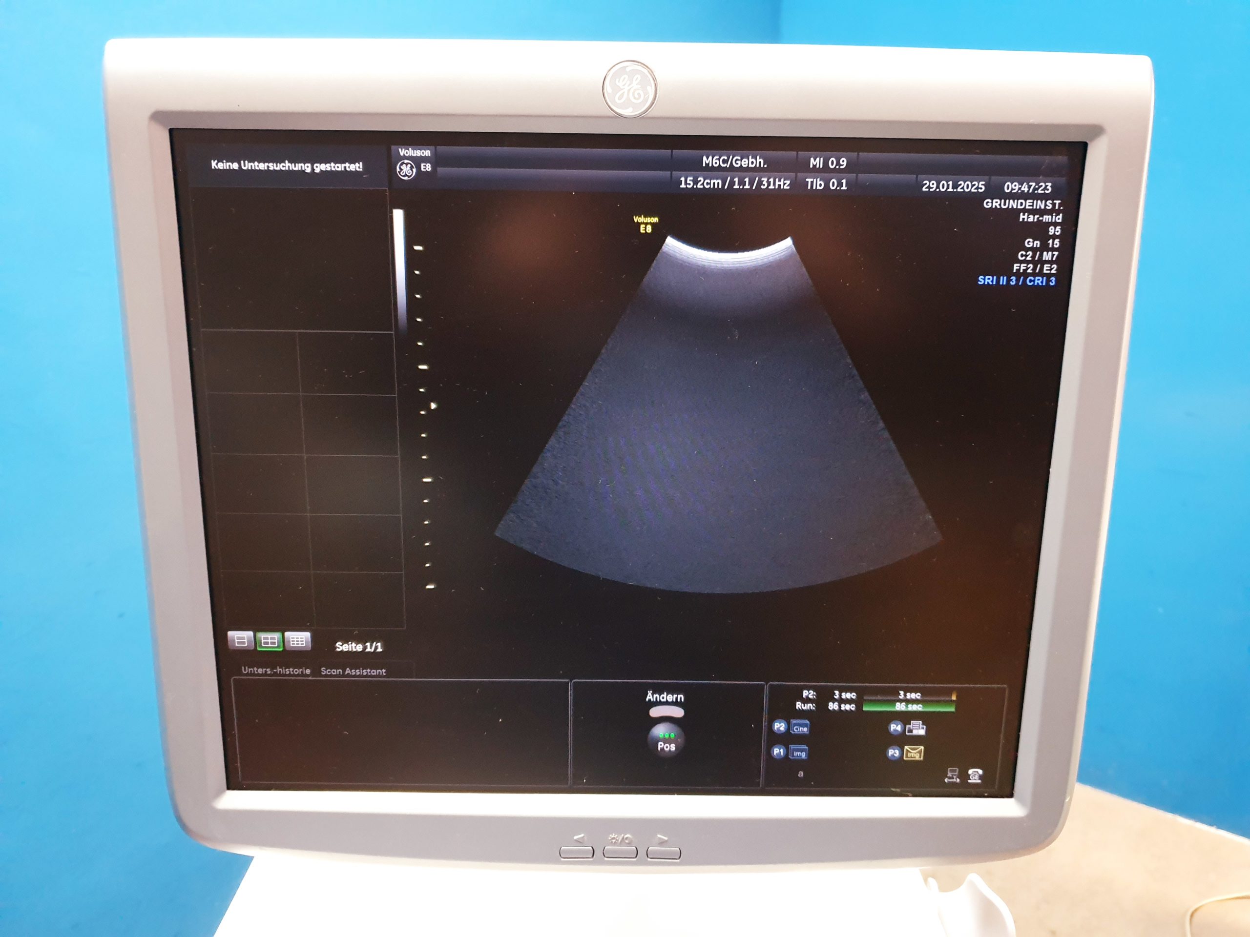 GE M6C - Konvex Sonde - soll neu beschichtet werden – Bild 4