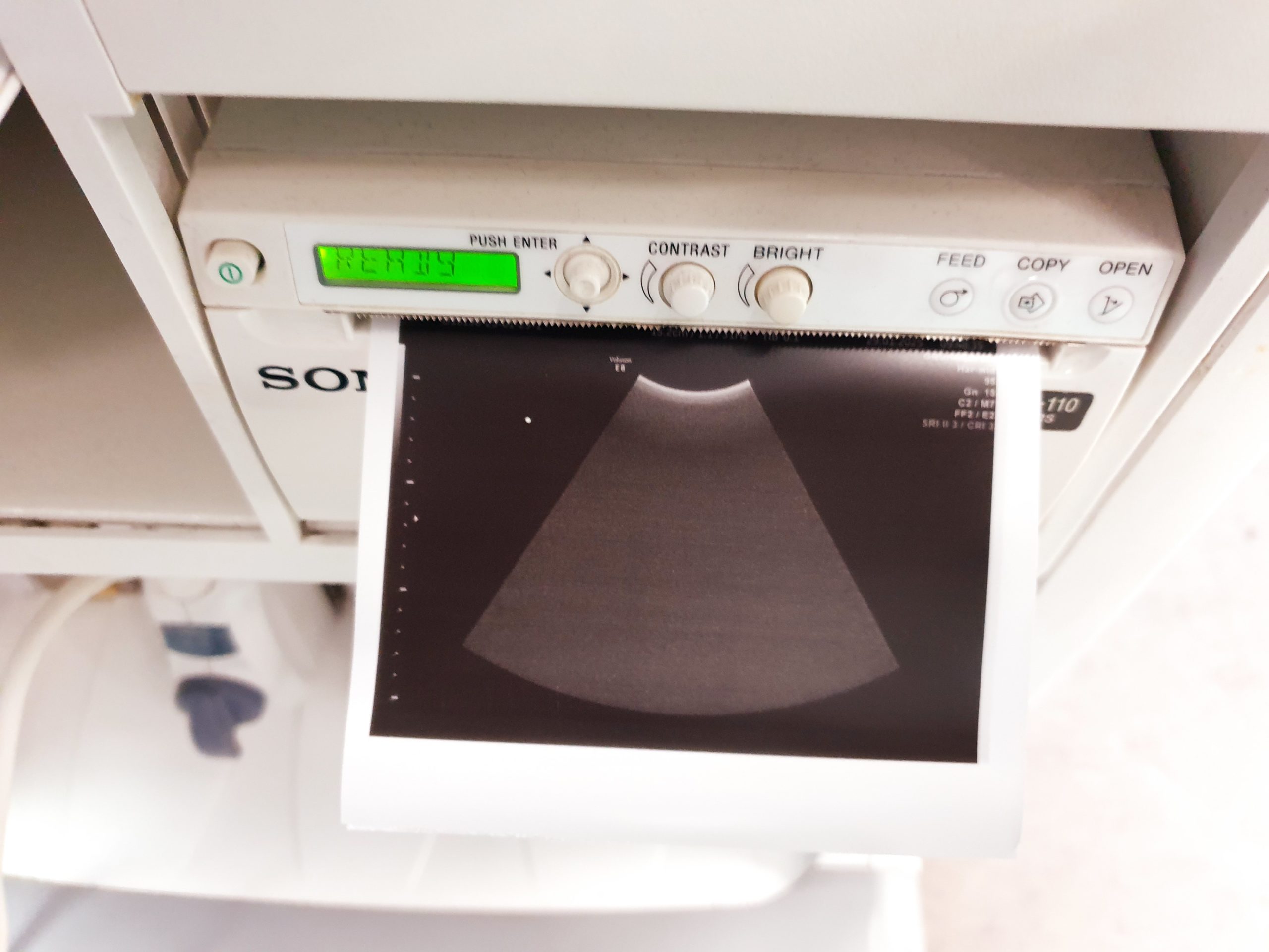 GE M6C - Konvex Sonde - soll neu beschichtet werden – Bild 5