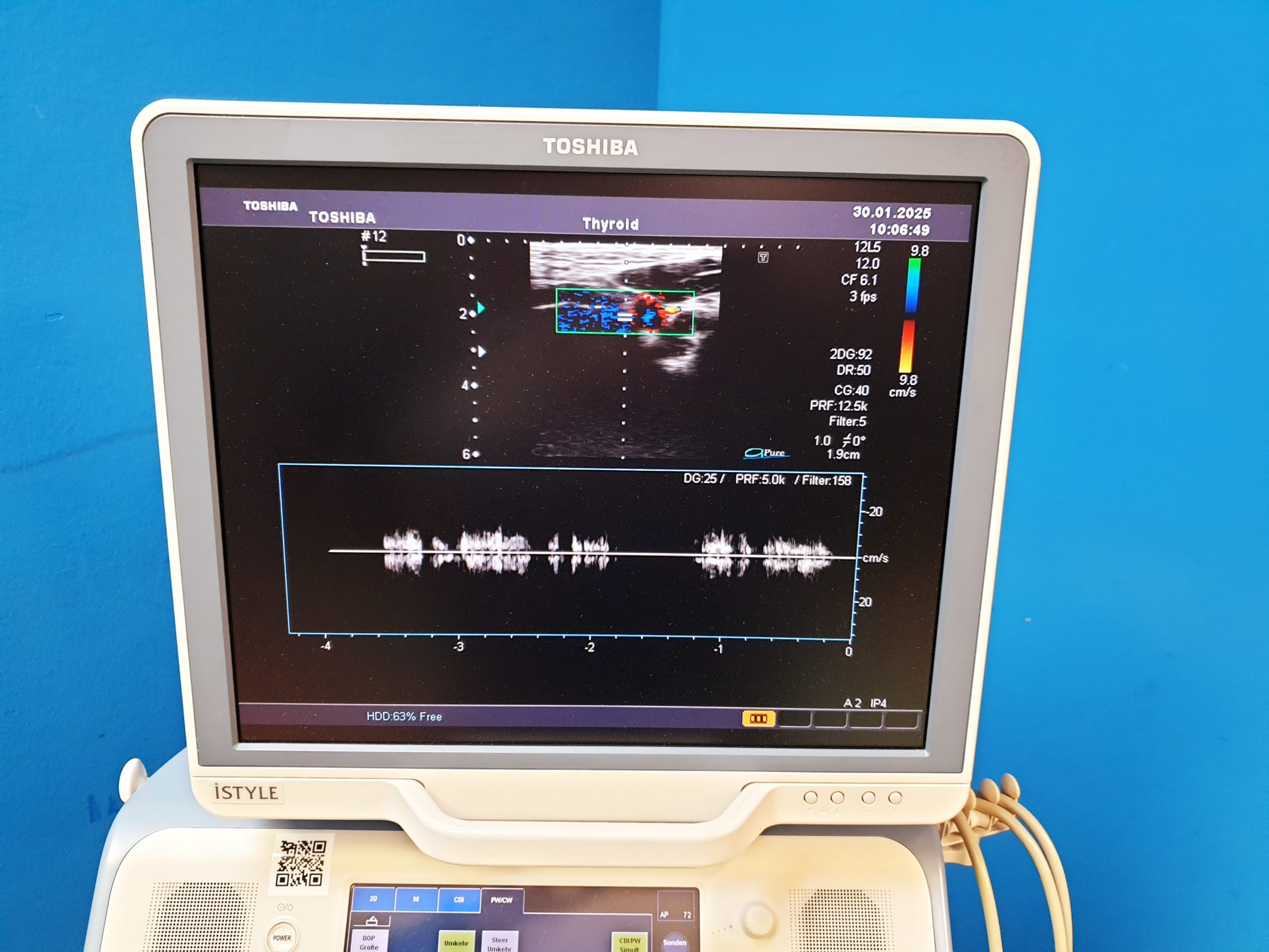 Toshiba SSA-680A Xario XG Farbdoppler PVT-375BT + PLT-805AT + PLT-704SBT – Bild 5
