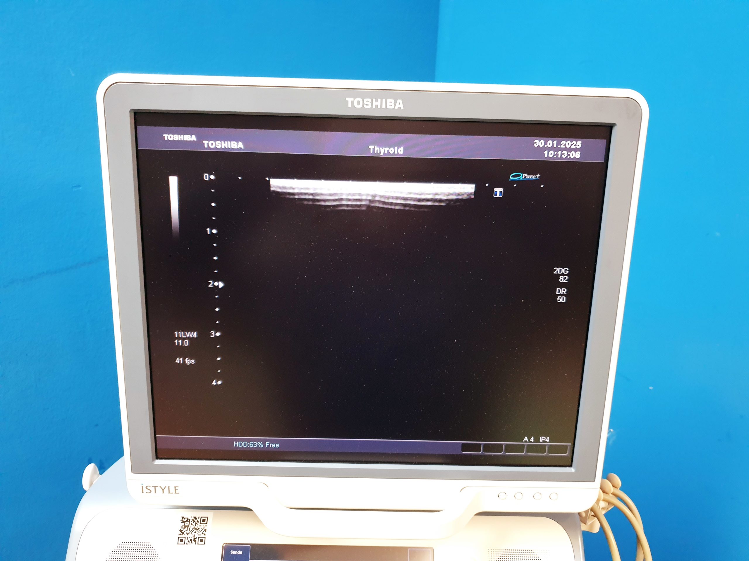 Toshiba SSA-680A Xario XG Farbdoppler PVT-375BT + PLT-805AT + PLT-704SBT – Bild 11