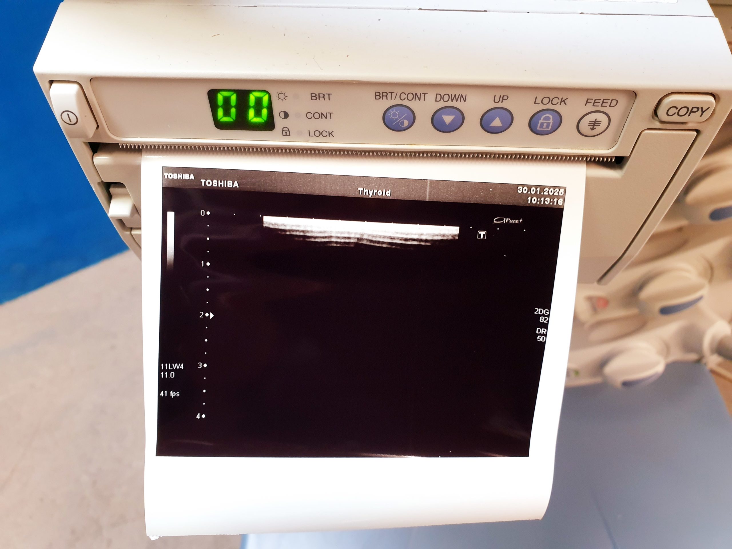 Toshiba SSA-680A Xario XG Farbdoppler PVT-375BT + PLT-805AT + PLT-704SBT – Bild 12