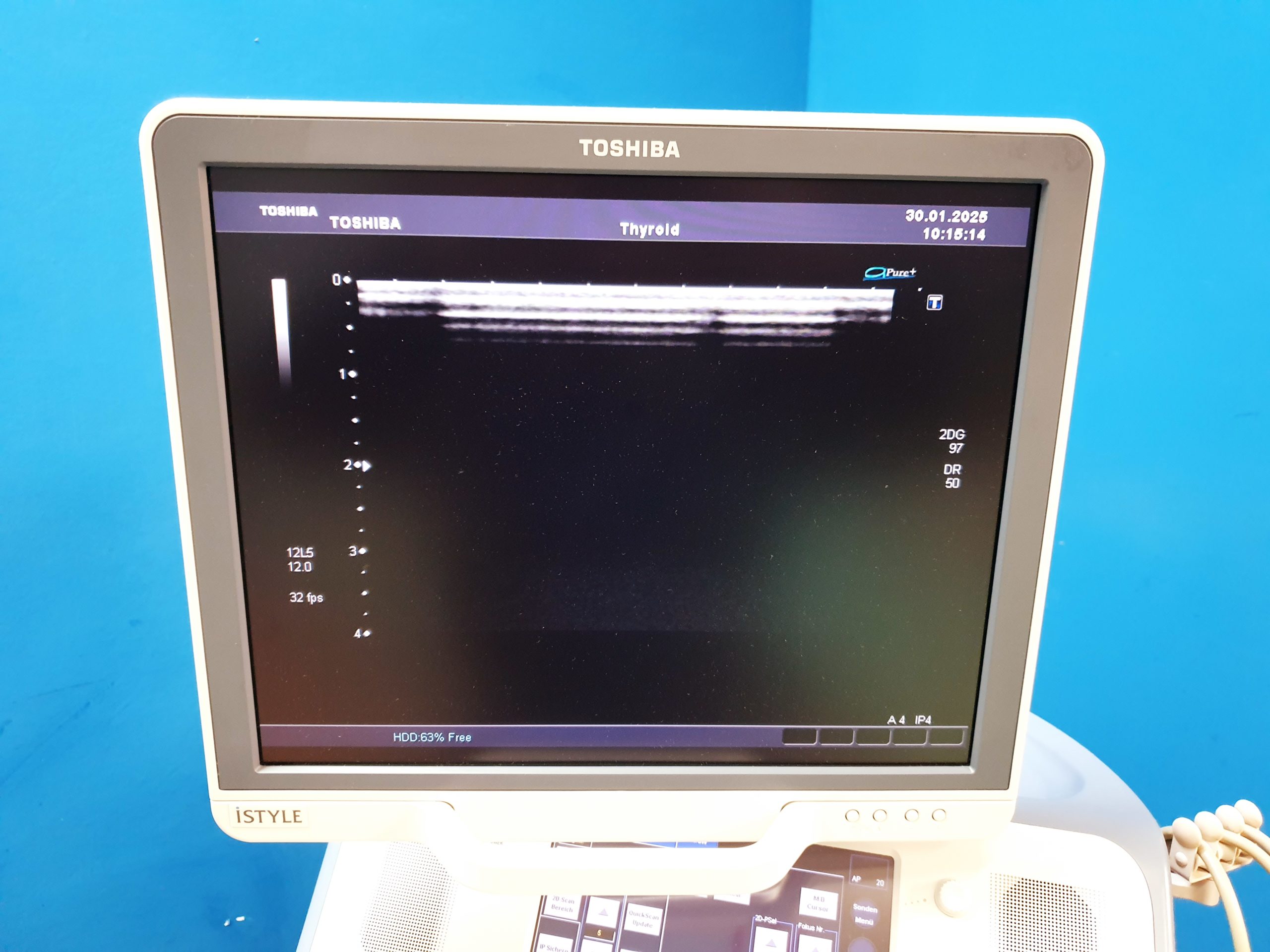 Toshiba SSA-680A Xario XG Farbdoppler PVT-375BT + PLT-805AT + PLT-704SBT – Bild 15