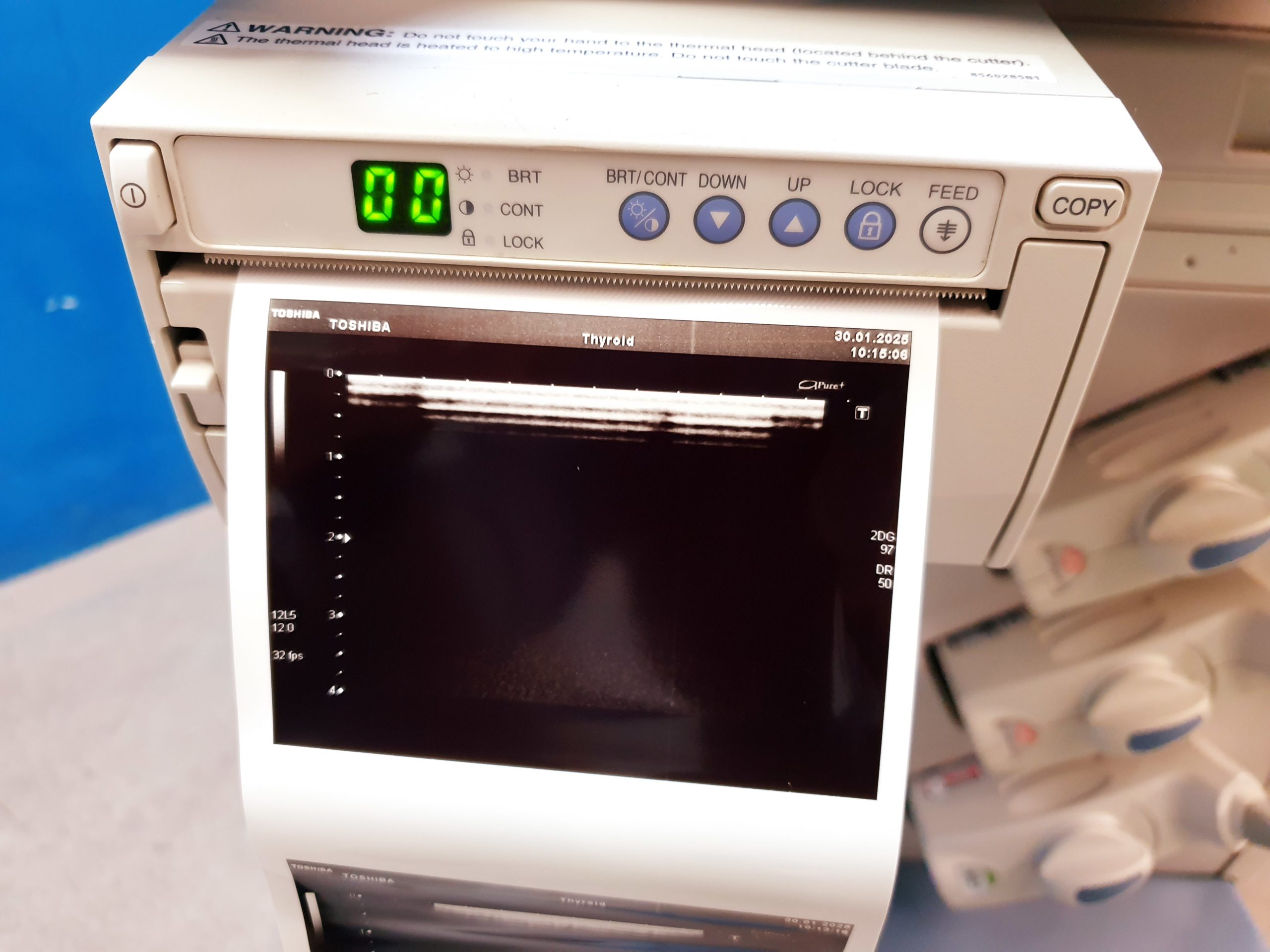 Toshiba SSA-680A Xario XG Farbdoppler PVT-375BT + PLT-805AT + PLT-704SBT – Bild 16