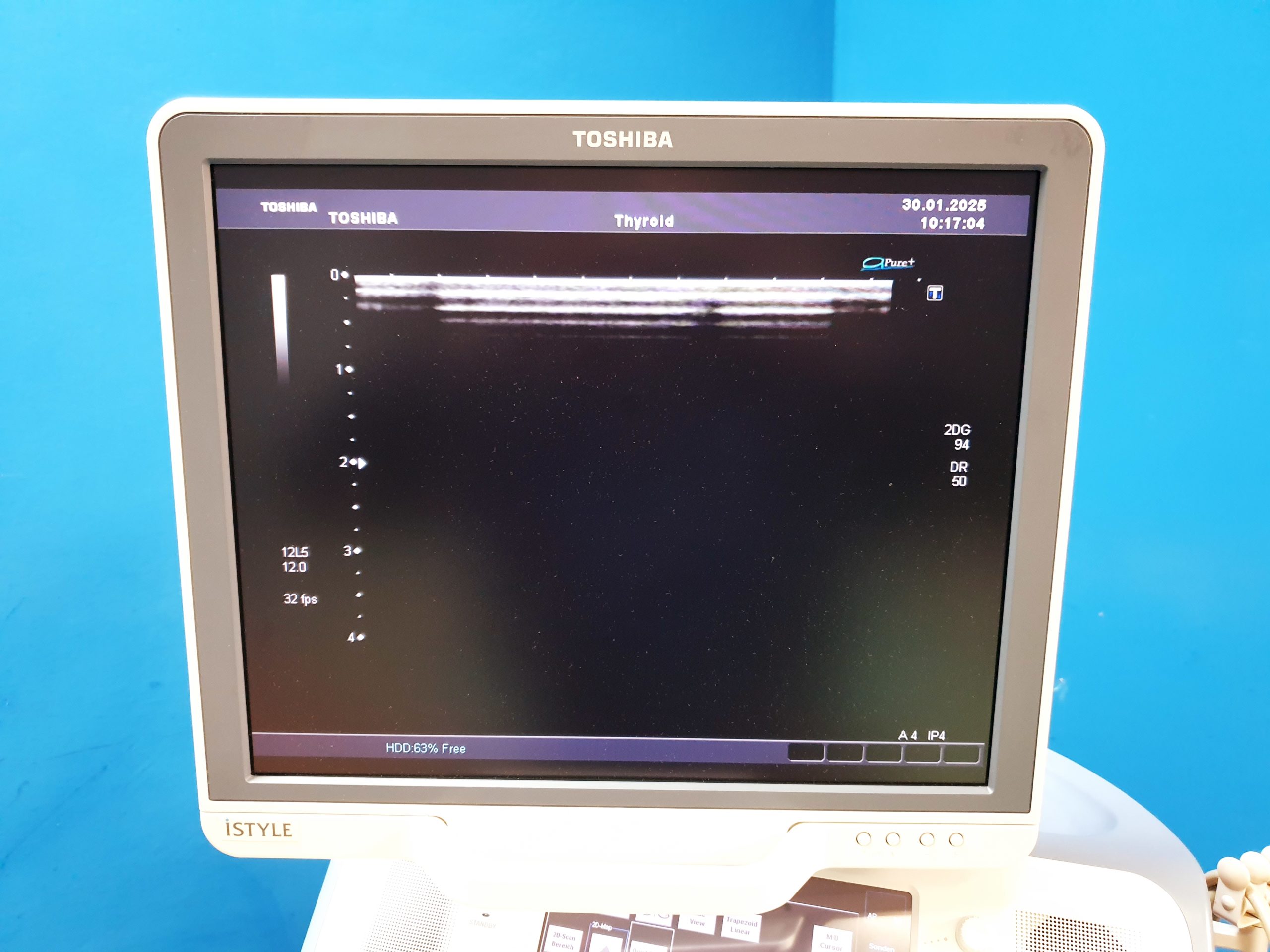 Toshiba SSA-680A Xario XG Farbdoppler PVT-375BT + PLT-805AT + PLT-704SBT – Bild 18