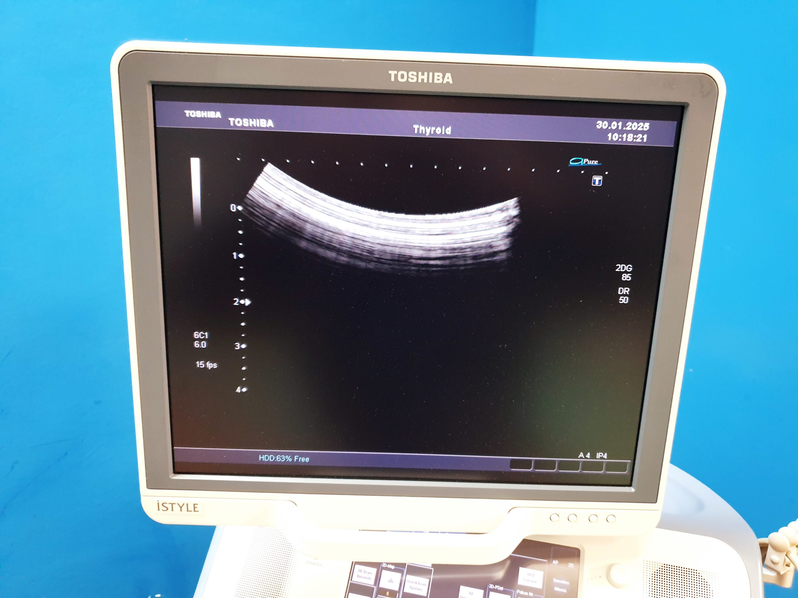 Toshiba SSA-680A Xario XG Farbdoppler PVT-375BT + PLT-805AT + PLT-704SBT – Bild 21