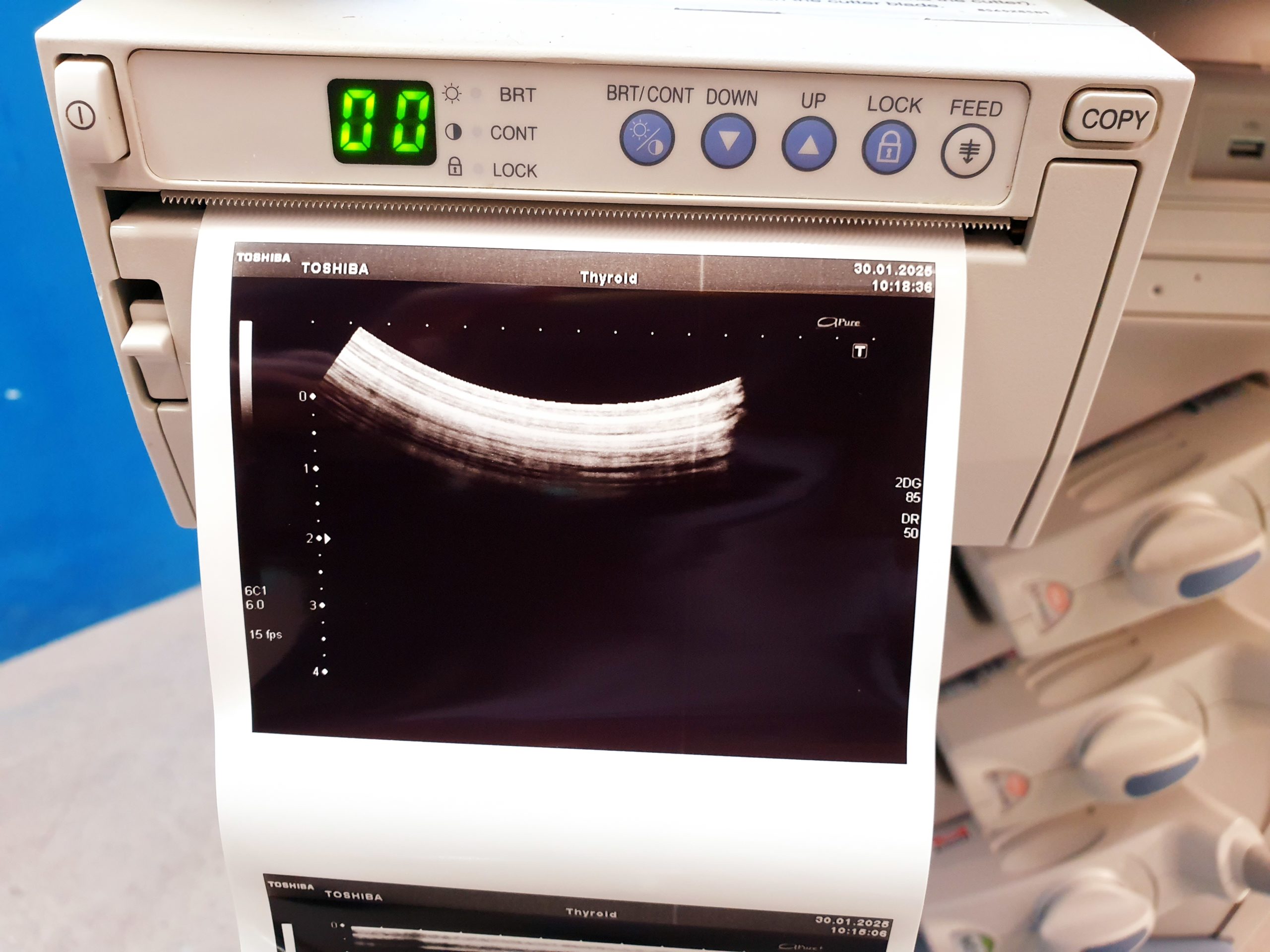 Toshiba SSA-680A Xario XG Farbdoppler PVT-375BT + PLT-805AT + PLT-704SBT – Bild 22