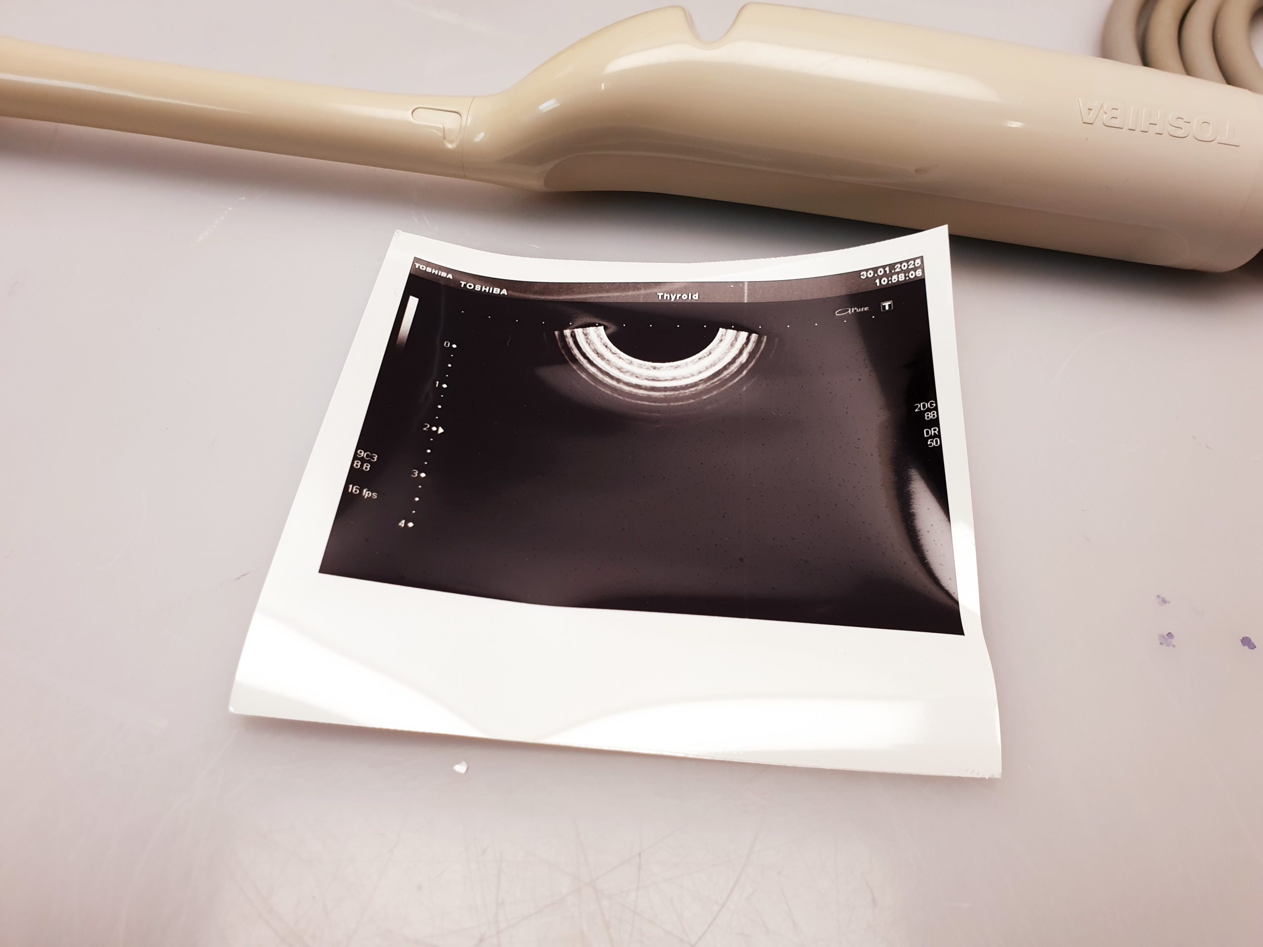 Toshiba 9C3 - PVT-661VT - Endovaginale – Bild 5