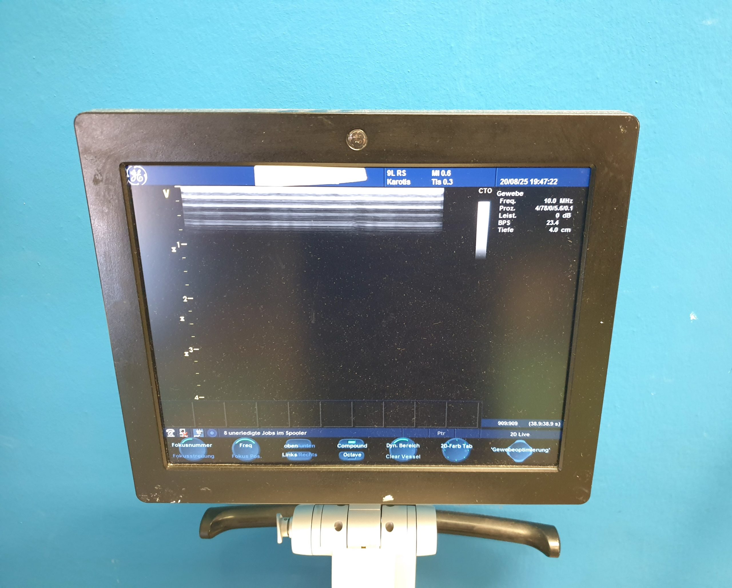 GE 9L-RS Linear Sonde Ultraschallsonde – Bild 19