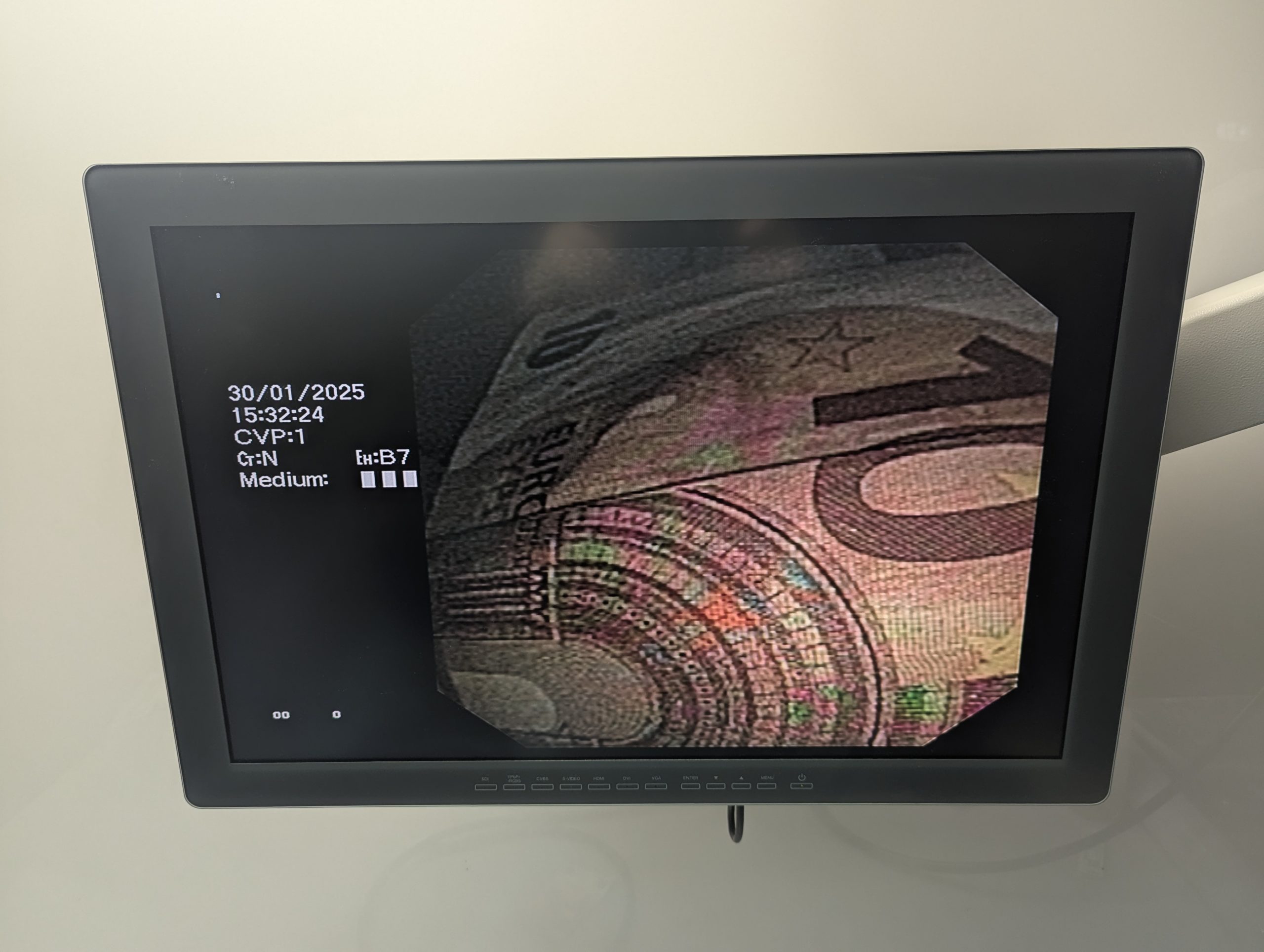 Olympus JF-140R Videoduodenoskop – Bild 18