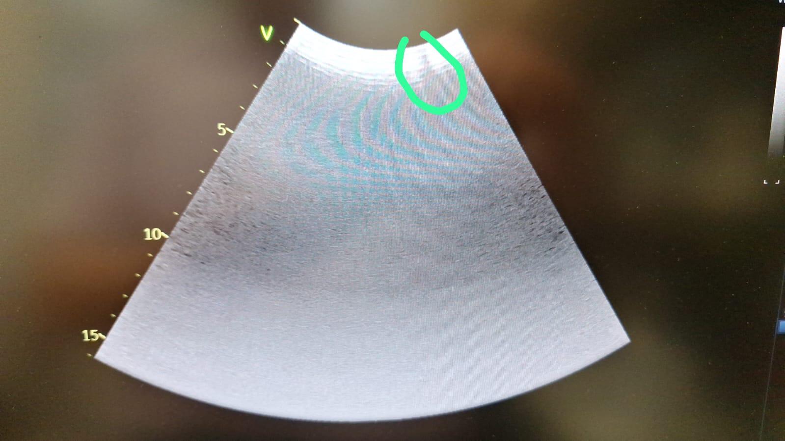 GE C1-6-D Ultraschallsonde Convex Sonde - DOM 2020 - DEFEKT – Bild 2