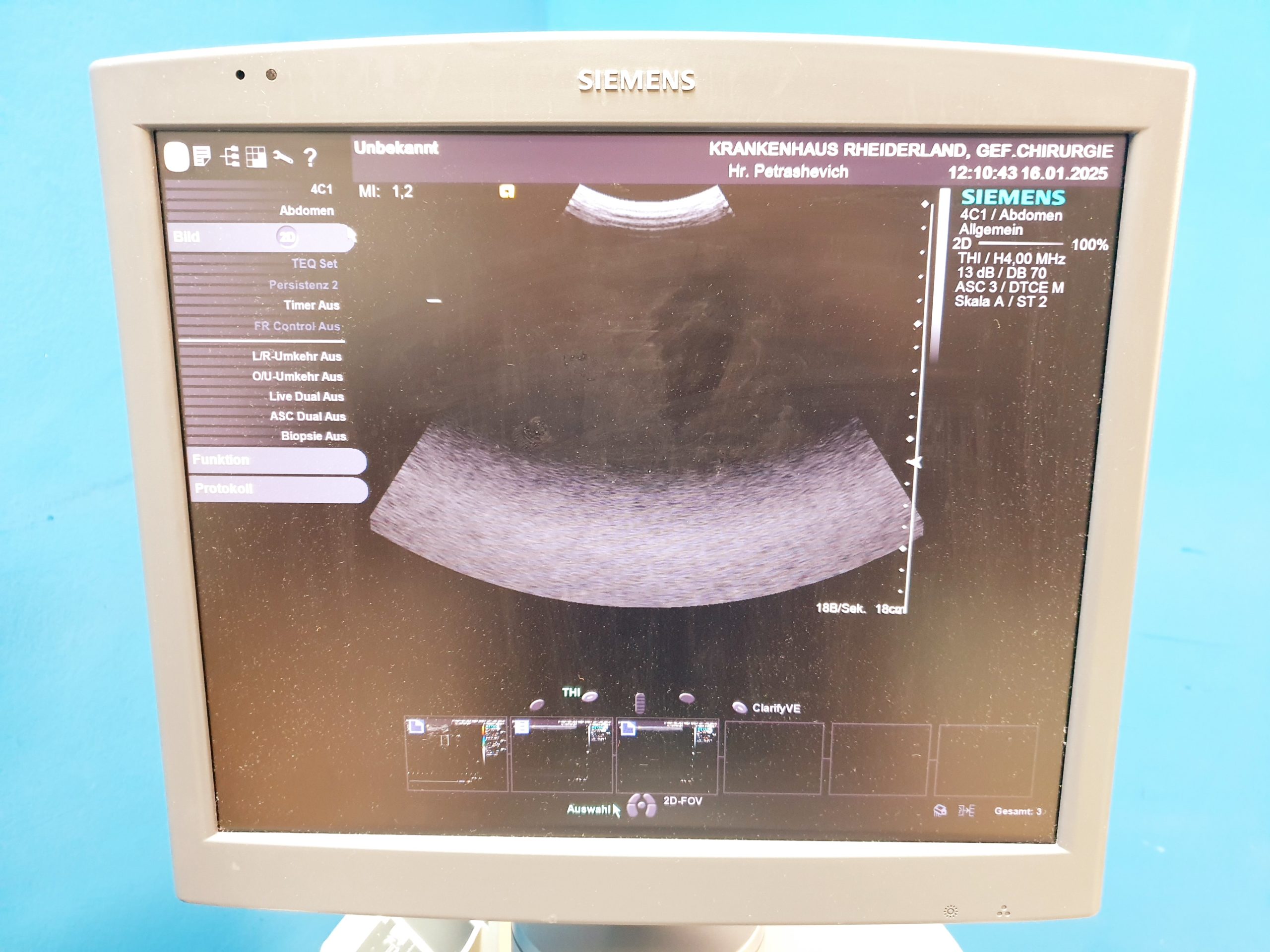 Siemens Acuson S2000 Baujahr 2011 mit drei Sonden Acuson 9L4, Acuson 4V1c, Acuson 4C1, – Bild 9