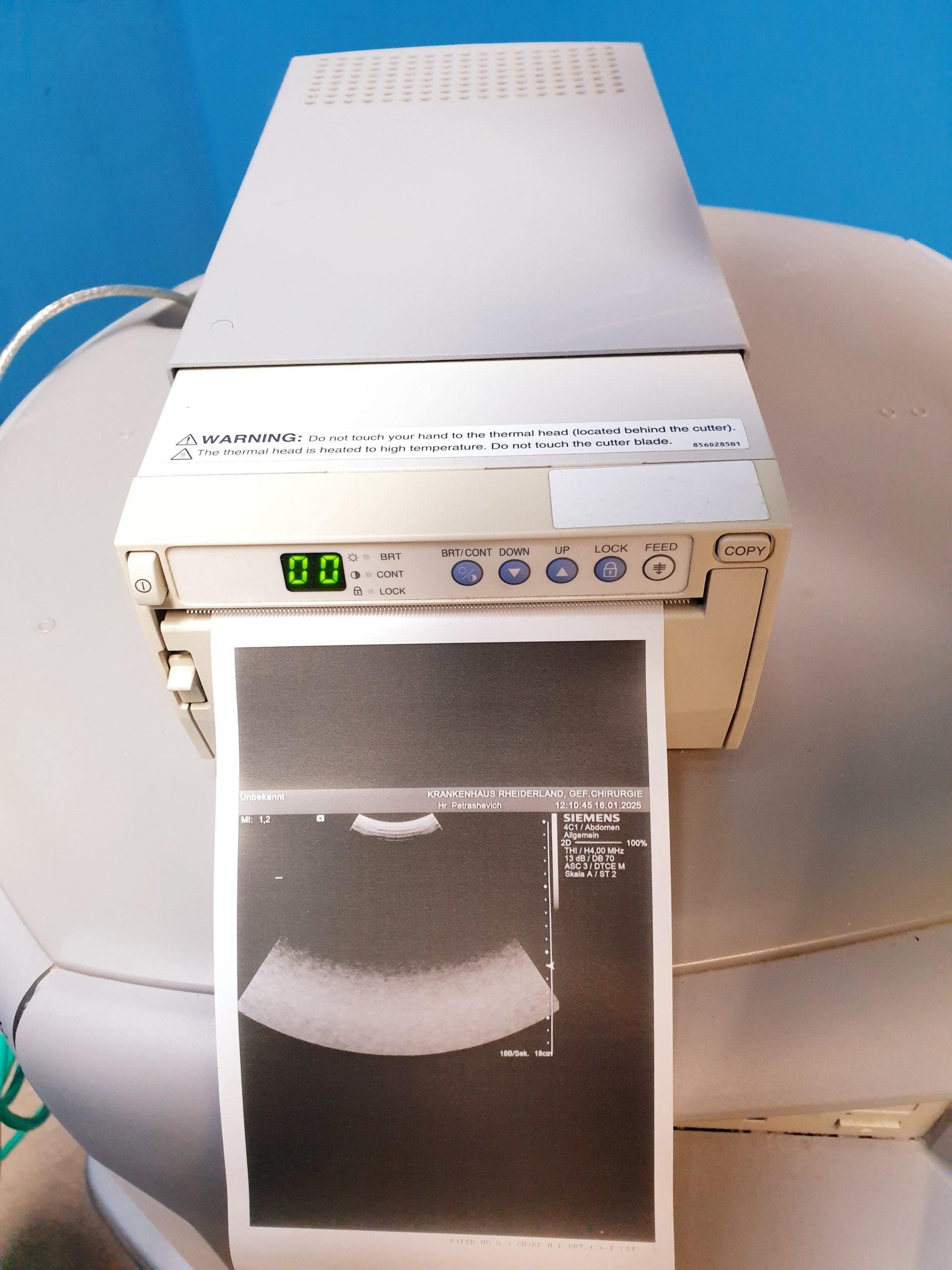 Siemens Acuson S2000 Baujahr 2011 mit drei Sonden Acuson 9L4, Acuson 4V1c, Acuson 4C1, – Bild 10