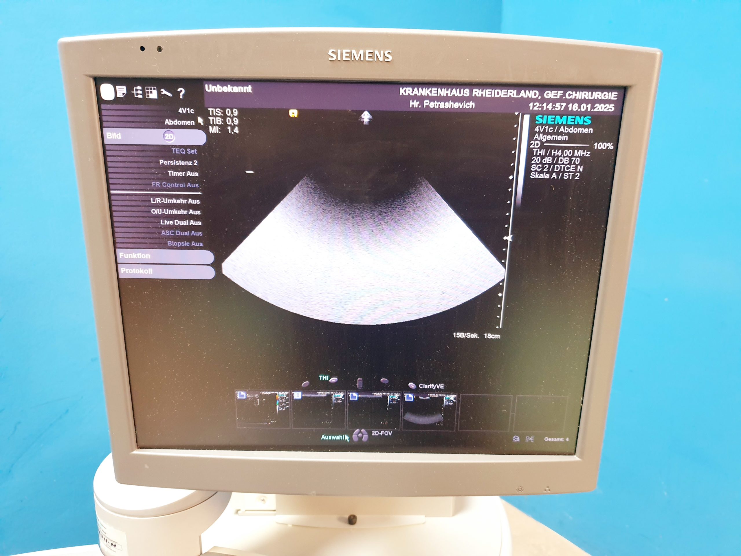 Siemens Acuson S2000 Baujahr 2011 mit drei Sonden Acuson 9L4, Acuson 4V1c, Acuson 4C1, – Bild 15