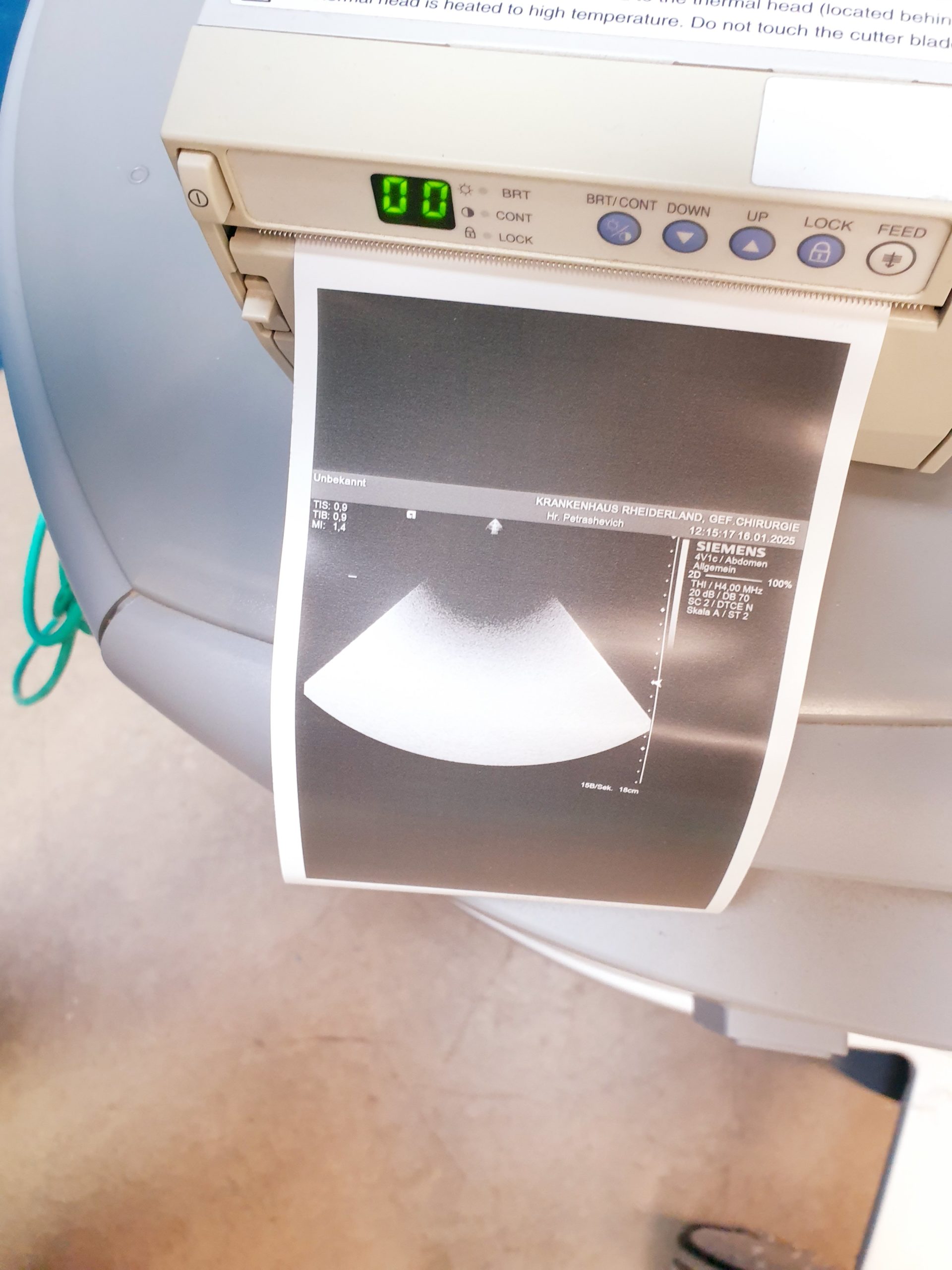 Siemens Acuson S2000 Baujahr 2011 mit drei Sonden Acuson 9L4, Acuson 4V1c, Acuson 4C1, – Bild 16