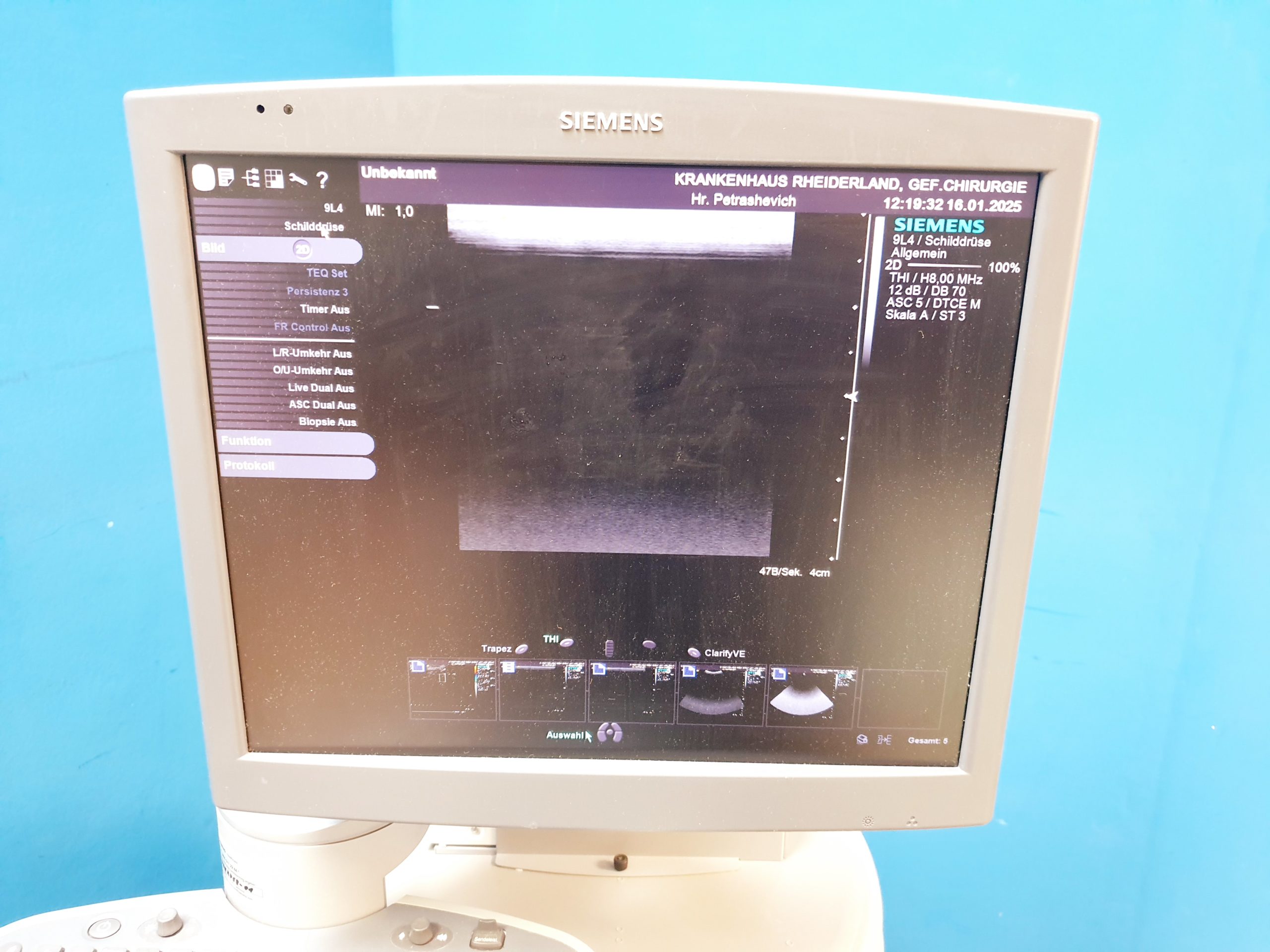 Siemens Acuson S2000 Baujahr 2011 mit drei Sonden Acuson 9L4, Acuson 4V1c, Acuson 4C1, – Bild 21