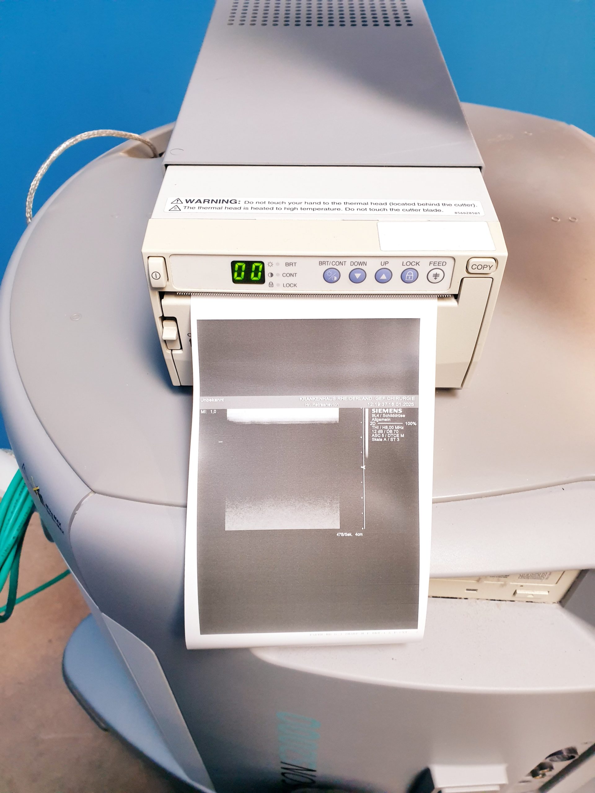 Siemens Acuson S2000 Baujahr 2011 mit drei Sonden Acuson 9L4, Acuson 4V1c, Acuson 4C1, – Bild 22