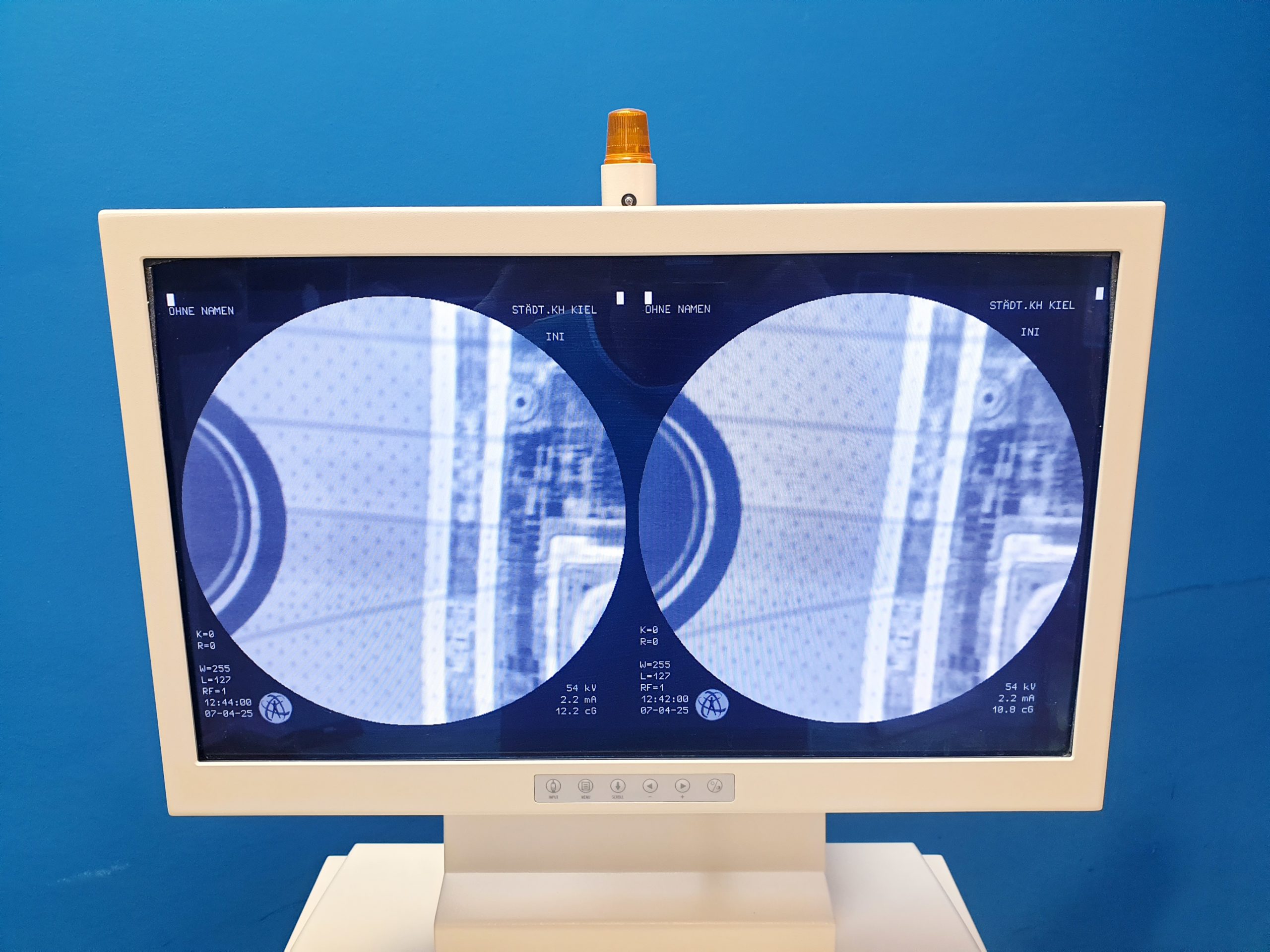 Ziehm 8000 C-Bogen C Arm Röntgengerät mit Flachmonitore- – Bild 3