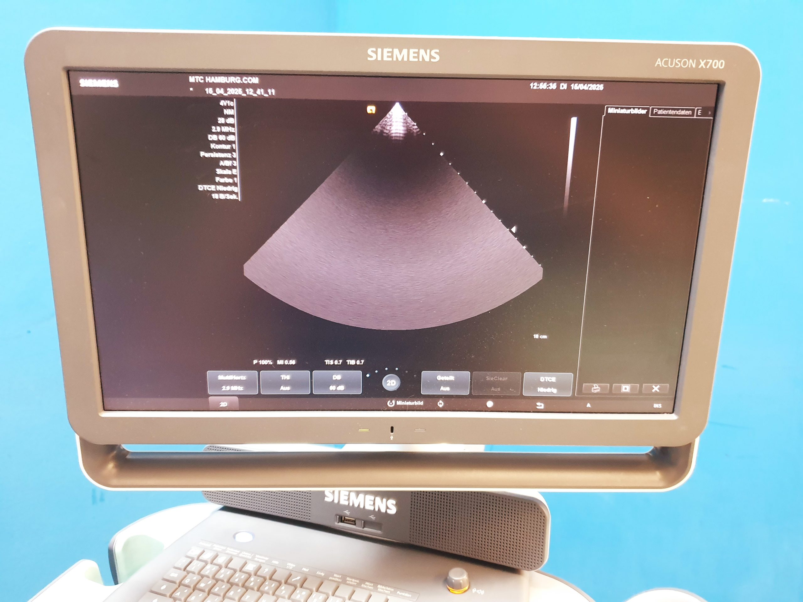 Siemens Acuson X700 Farbdoppler + 6C2 + 4V1c Echo – Bild 8