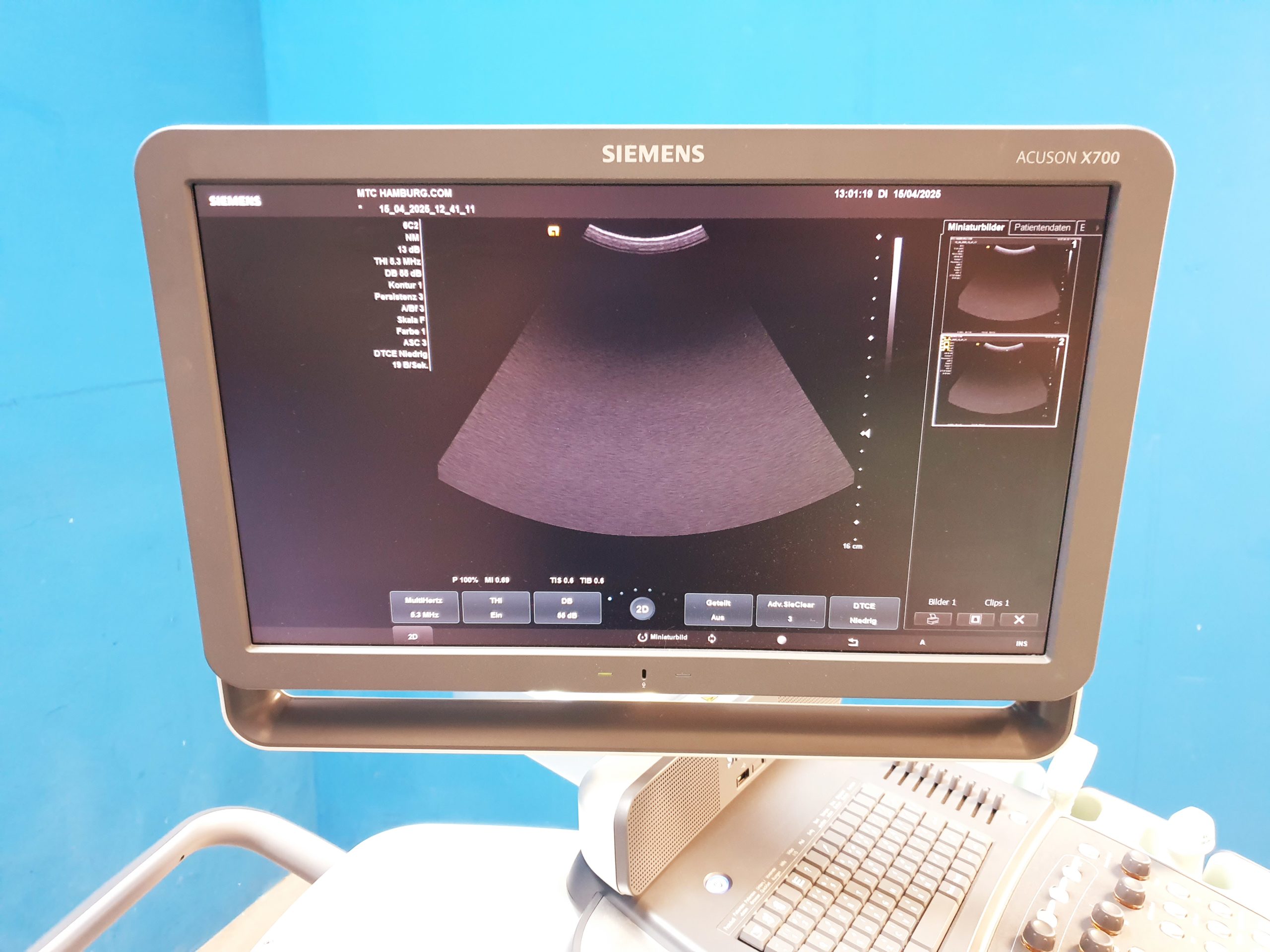 Siemens Acuson X700 Farbdoppler + 6C2 + 4V1c Echo – Bild 12