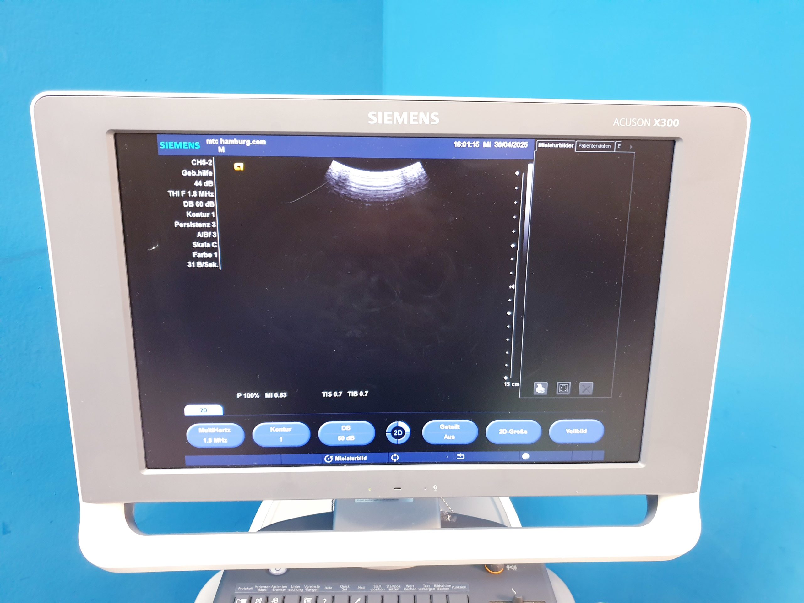 Siemens Acuson X300 X 300 Premium Edition – + CH5-2 Konvex + EC9-4 Endovaginal -- – Bild 7