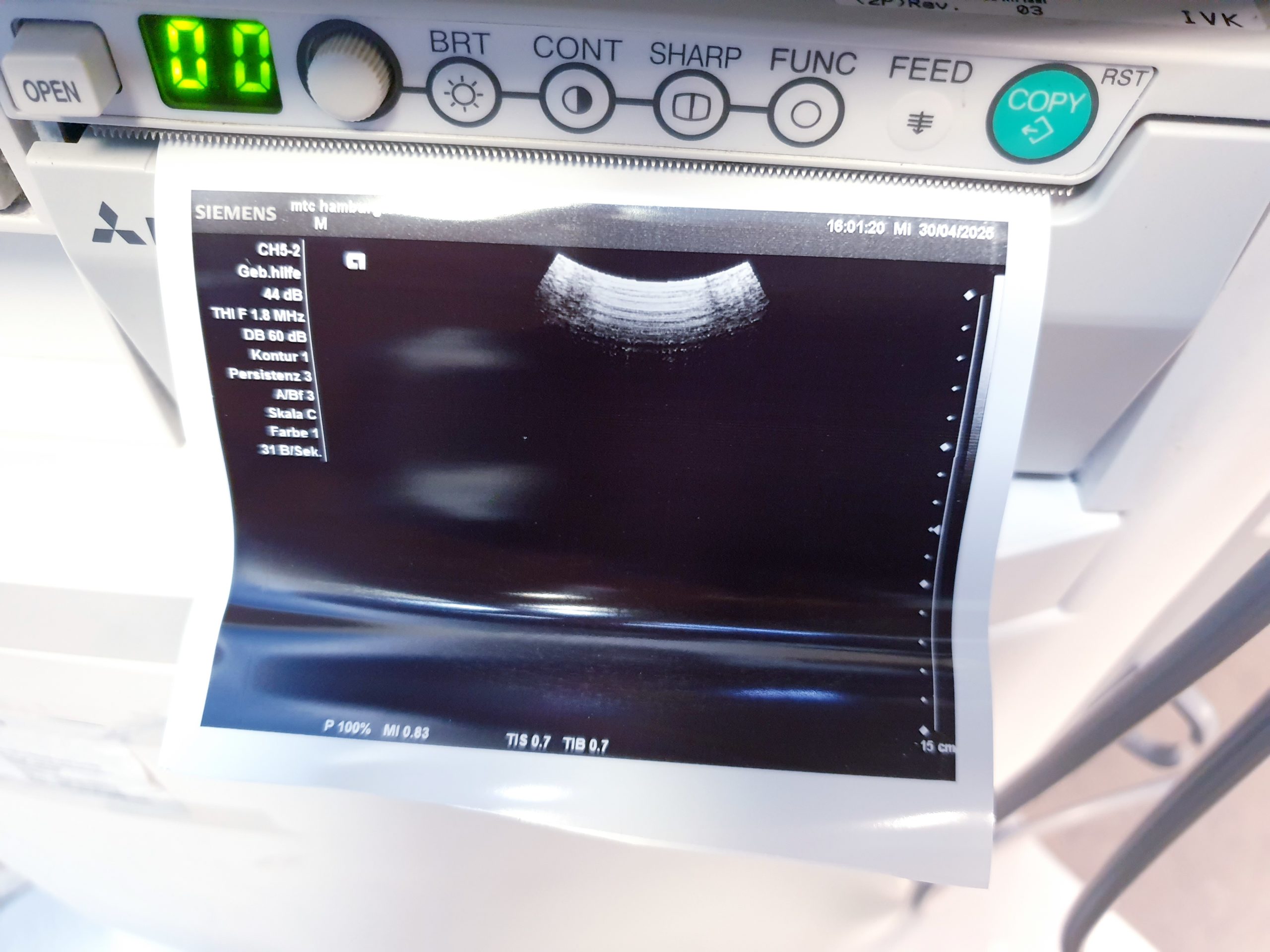 Siemens Acuson X300 X 300 Premium Edition – + CH5-2 Konvex + EC9-4 Endovaginal -- – Bild 8