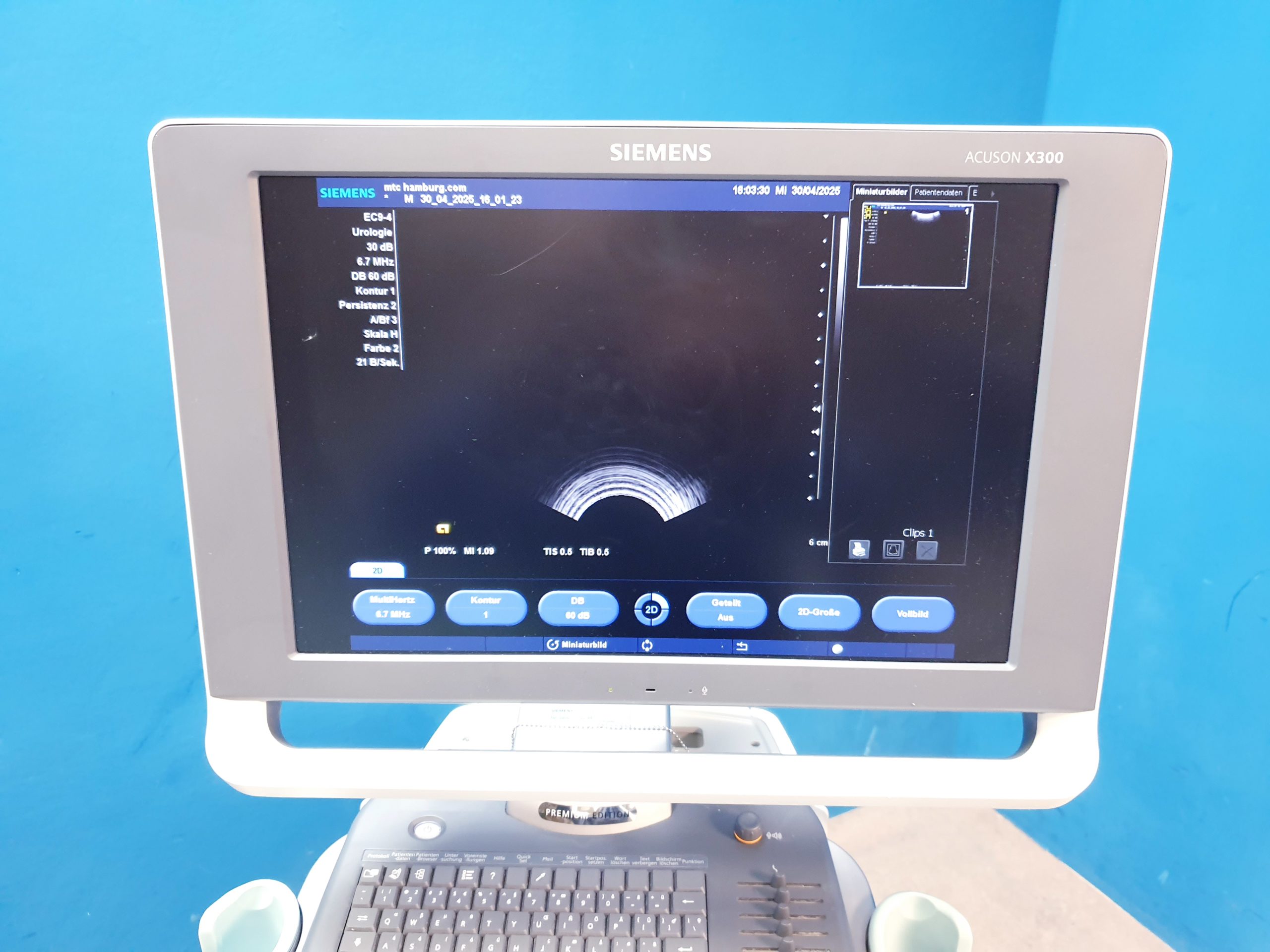 Siemens Acuson X300 X 300 Premium Edition – + CH5-2 Konvex + EC9-4 Endovaginal -- – Bild 14