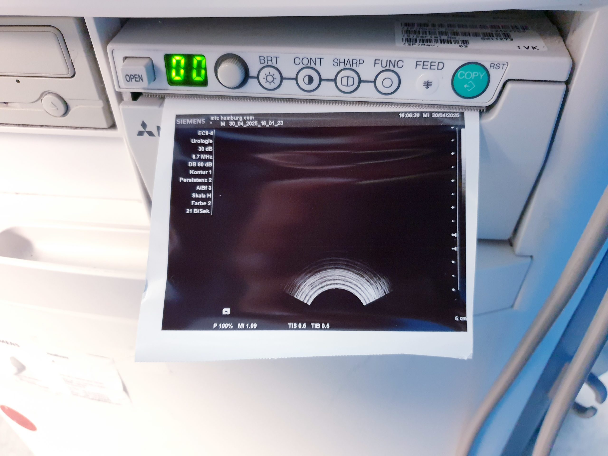 Siemens Acuson X300 X 300 Premium Edition – + CH5-2 Konvex + EC9-4 Endovaginal -- – Bild 16