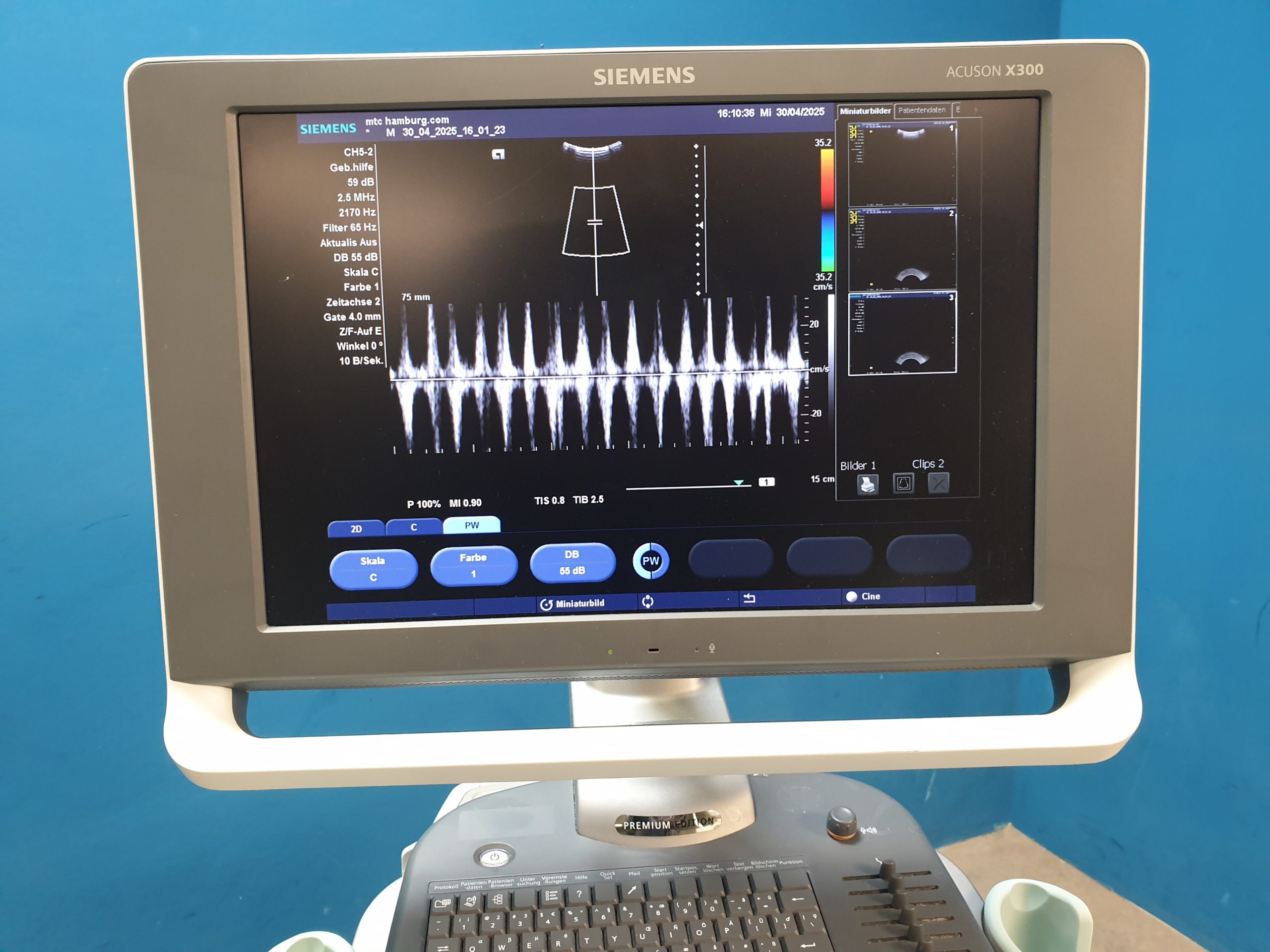 Siemens Acuson X300 X 300 Premium Edition – + CH5-2 Konvex + EC9-4 Endovaginal -- – Bild 22