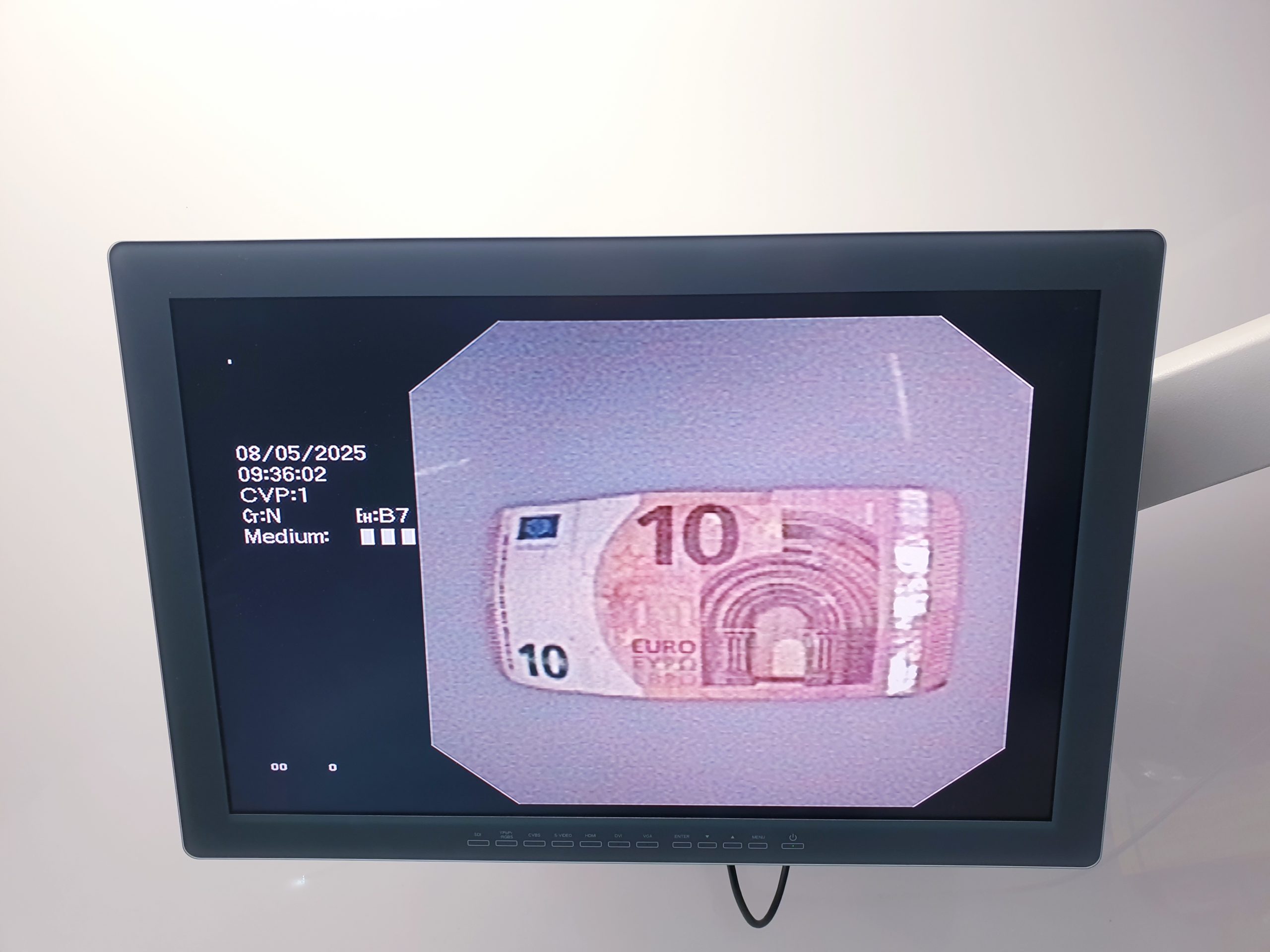 Olympus Evis Exera II BF-P180 BF P 180 Video-Bronchoskop - Videobronchoskop – Bild 12