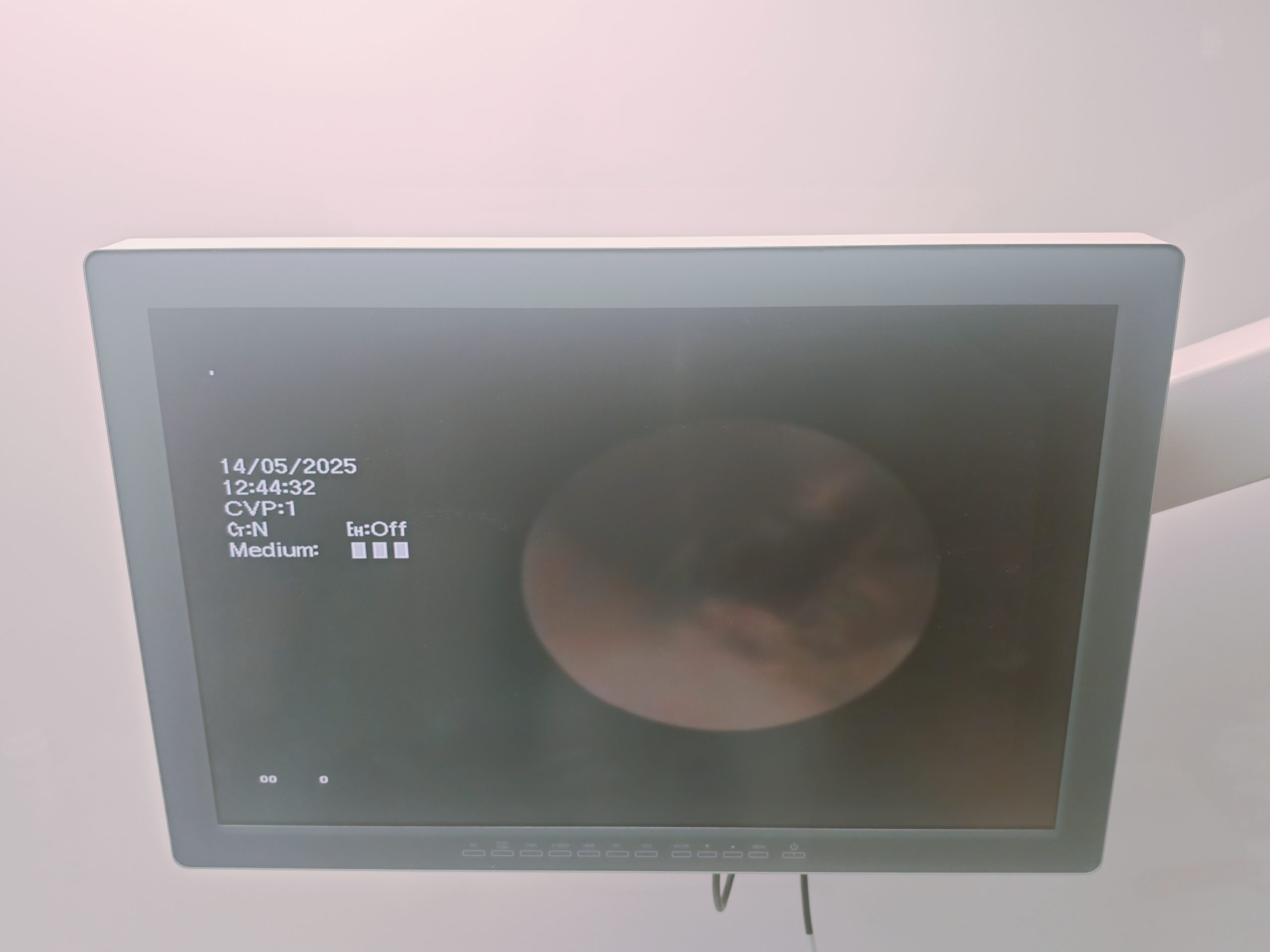 Olympus BF-XP160F Bronchoscope - Bronchoskop – Bild 14