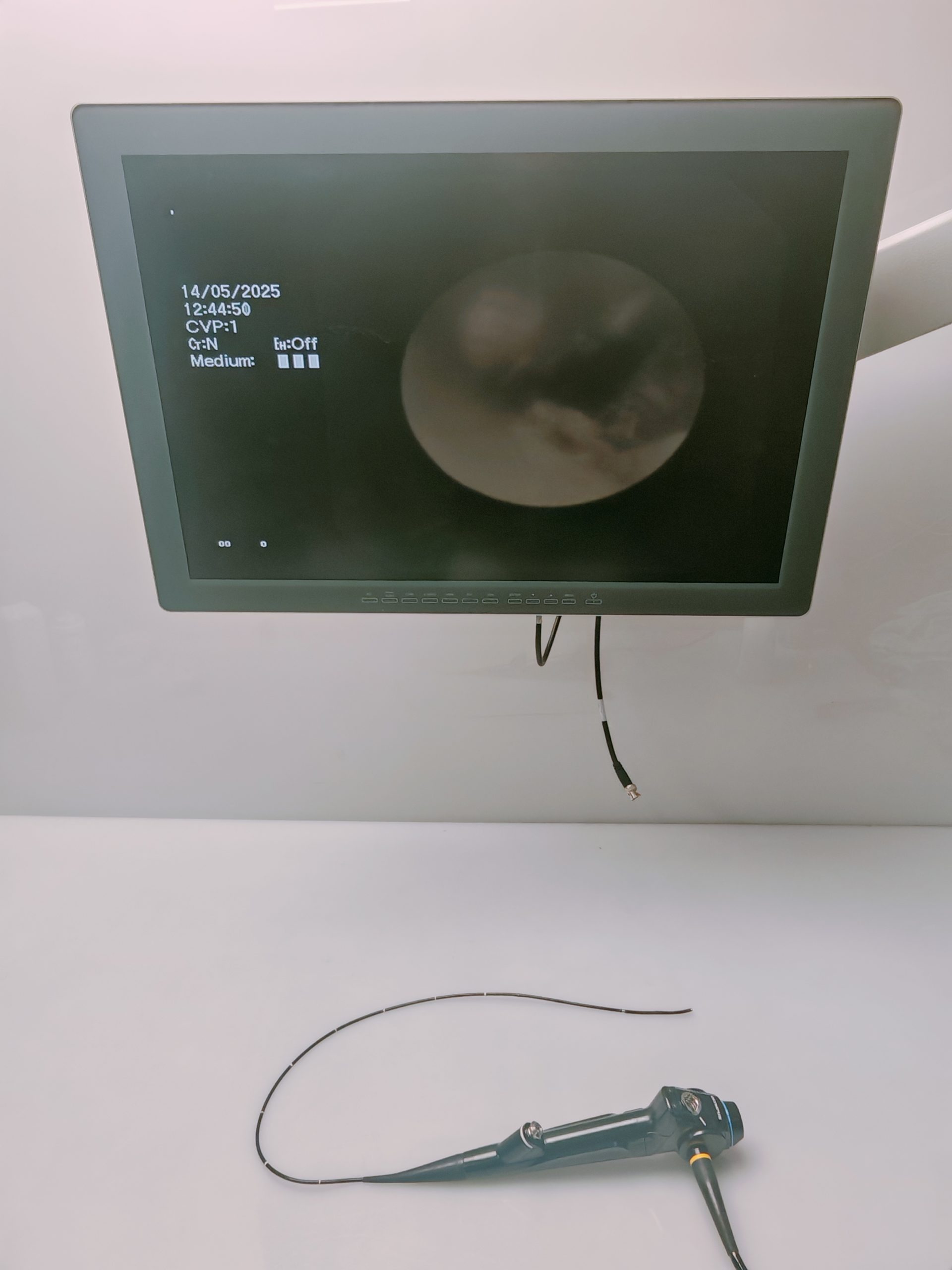 Olympus BF-XP160F Bronchoscope - Bronchoskop – Bild 15