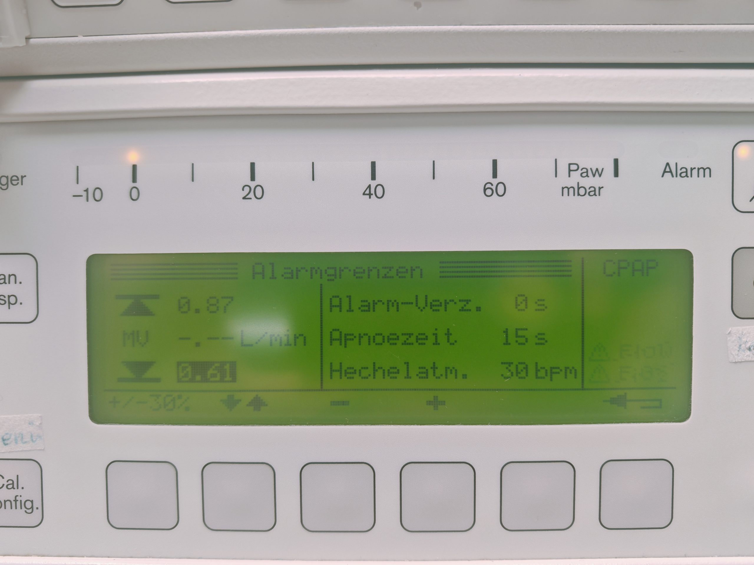 Dräger Drager Babylog 8000 + Capnostat - Beatmungsgerät – Bild 5