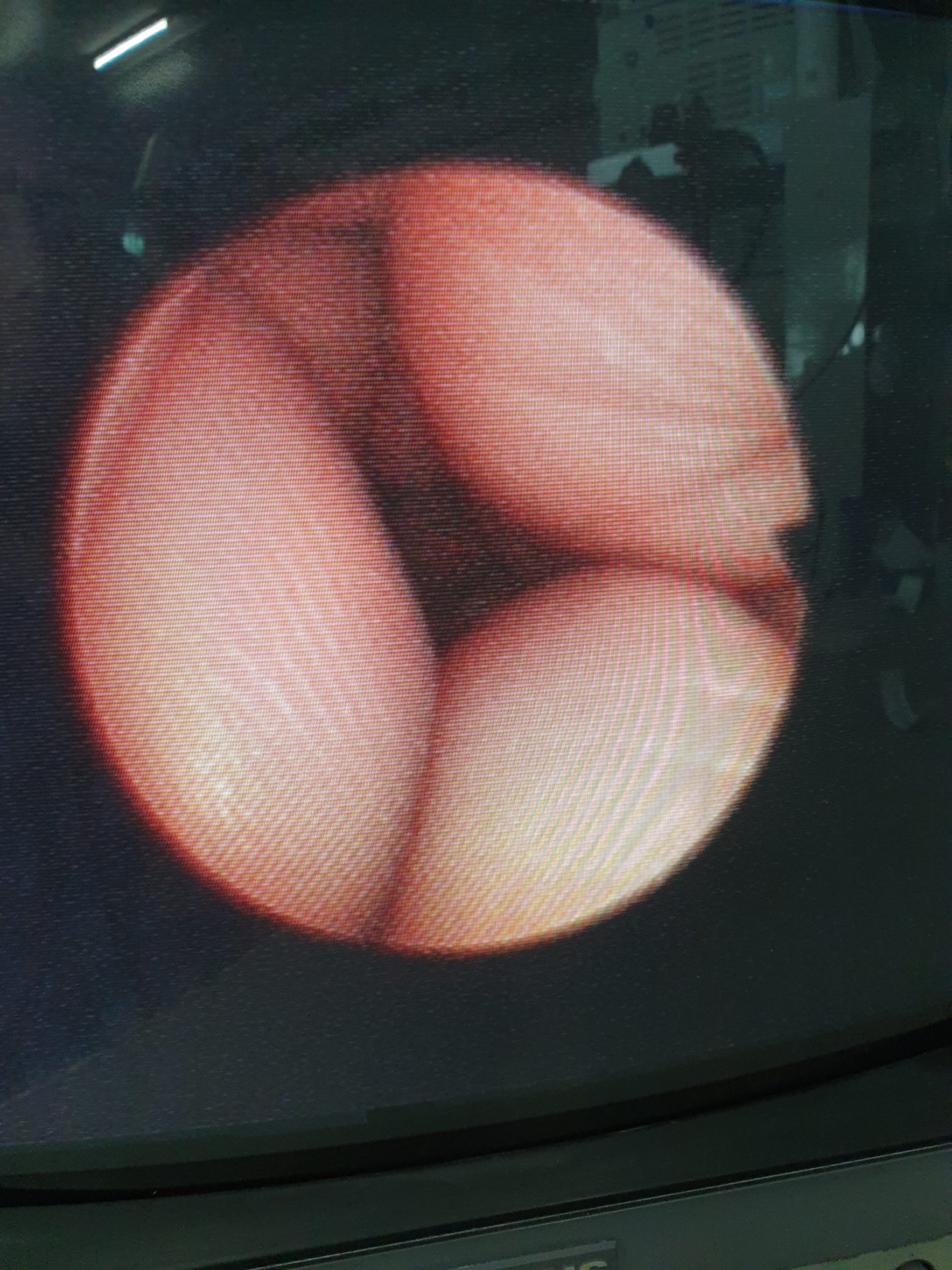 Olympus ENF TYPE-GP Fiberoskop Instrumente für die HNO-Chirurgie – Bild 10