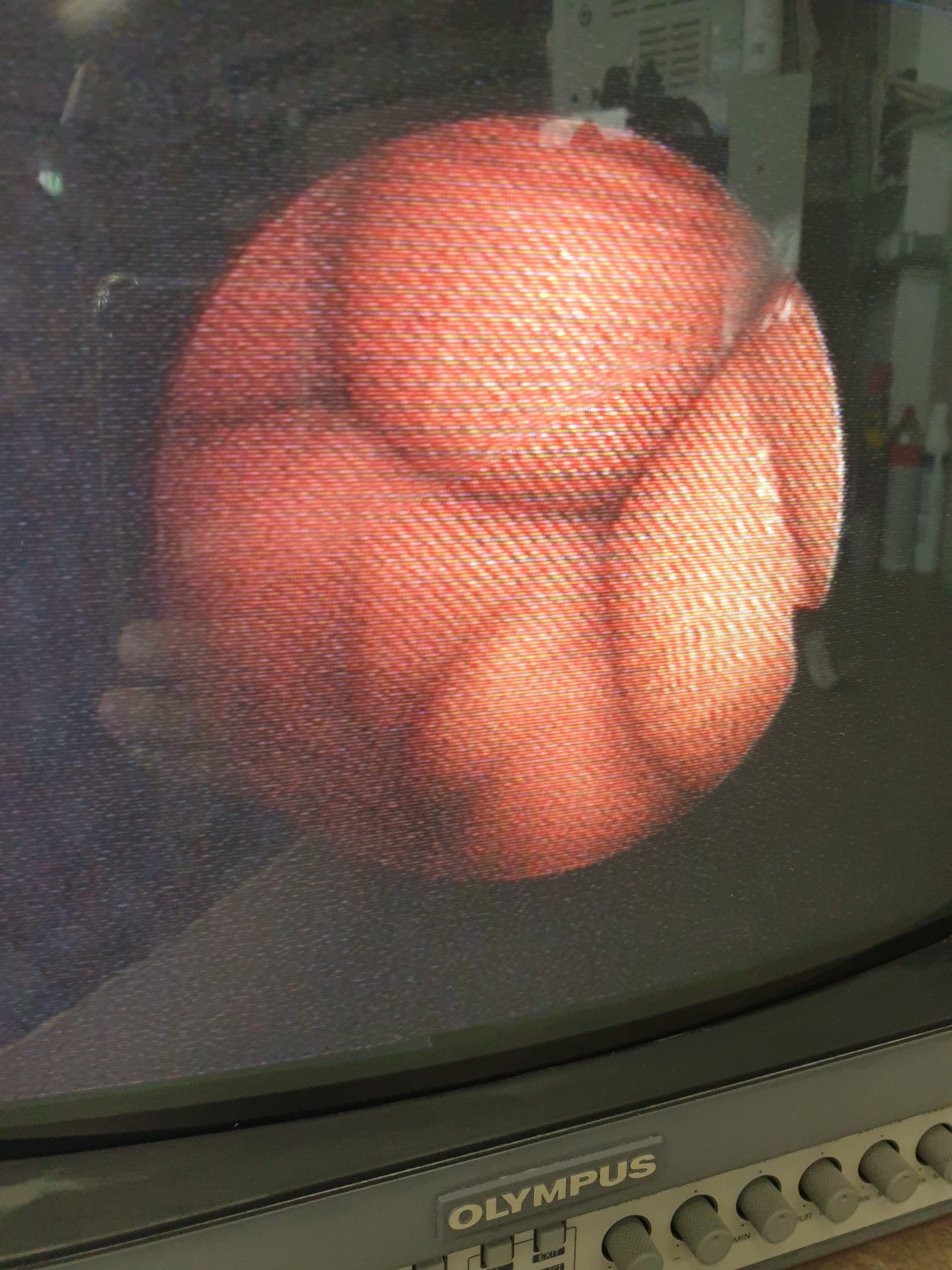 Olympus ENF TYPE-GP Fiberoskop Instrumente für die HNO-Chirurgie – Bild 11