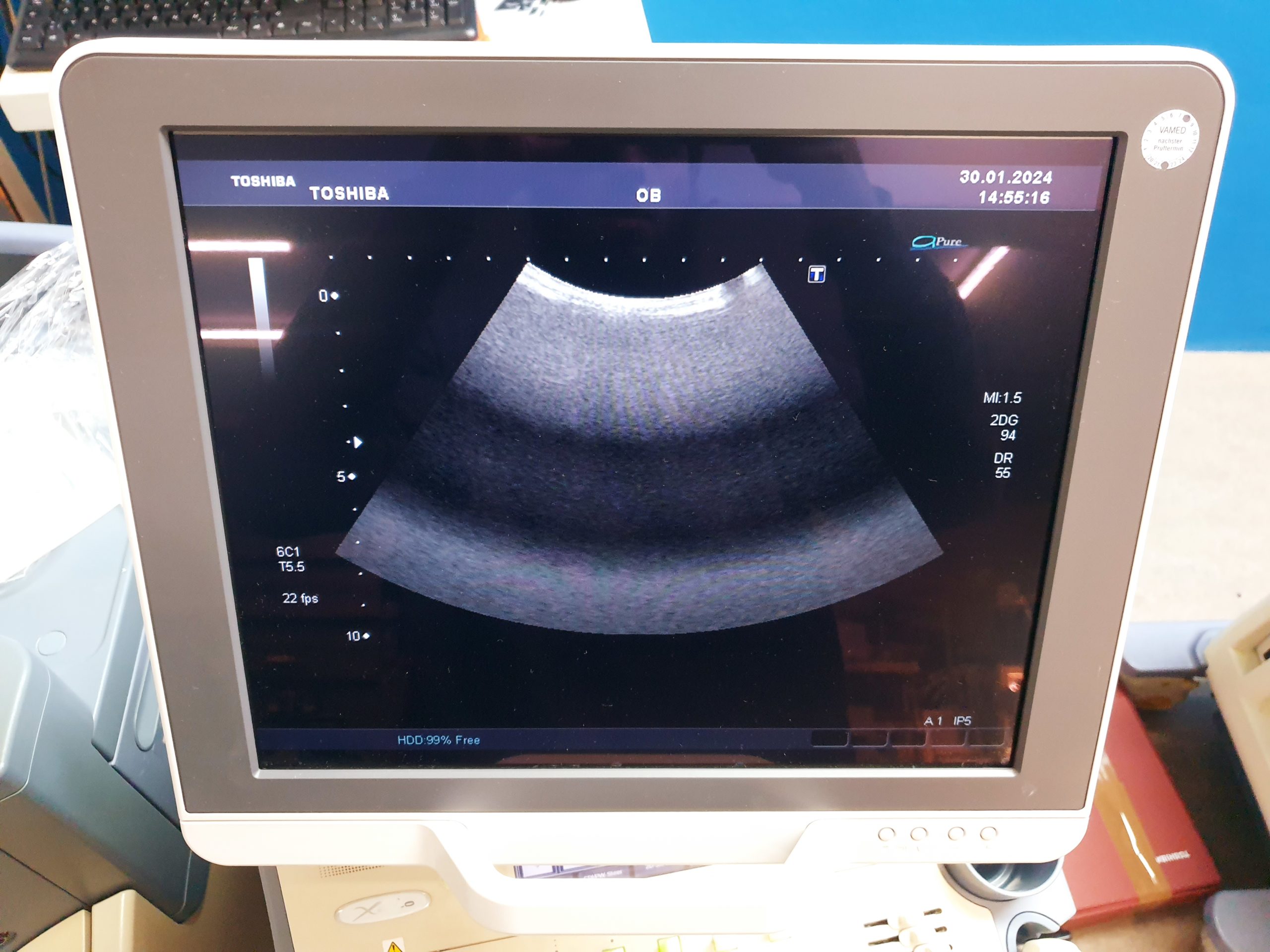 Toshiba PVT-375BT Konvex Sonde – Bild 3