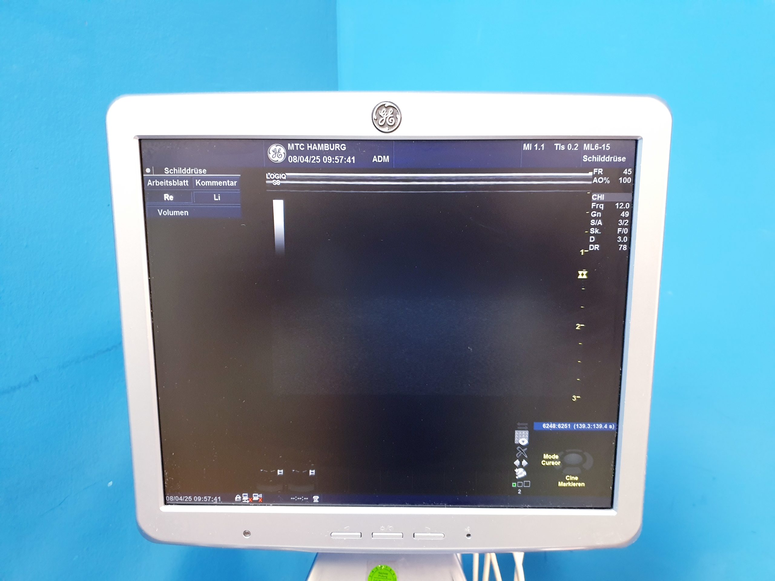 GE Logiq S8 + ML6-15 Linear + MS5-D Echo + C1-5 Konvex – Bild 9