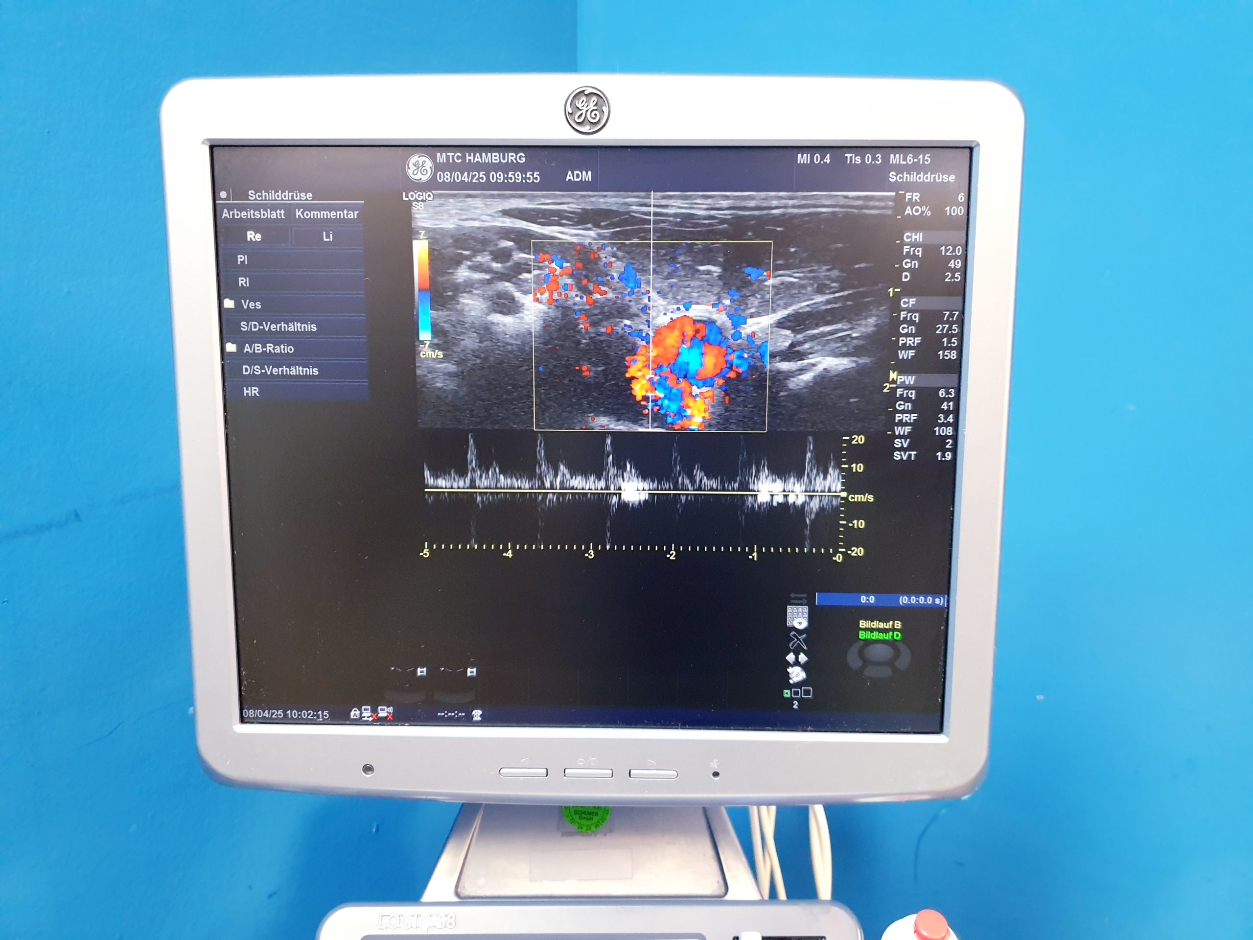 GE Logiq S8 + ML6-15 Linear + MS5-D Echo + C1-5 Konvex – Bild 12