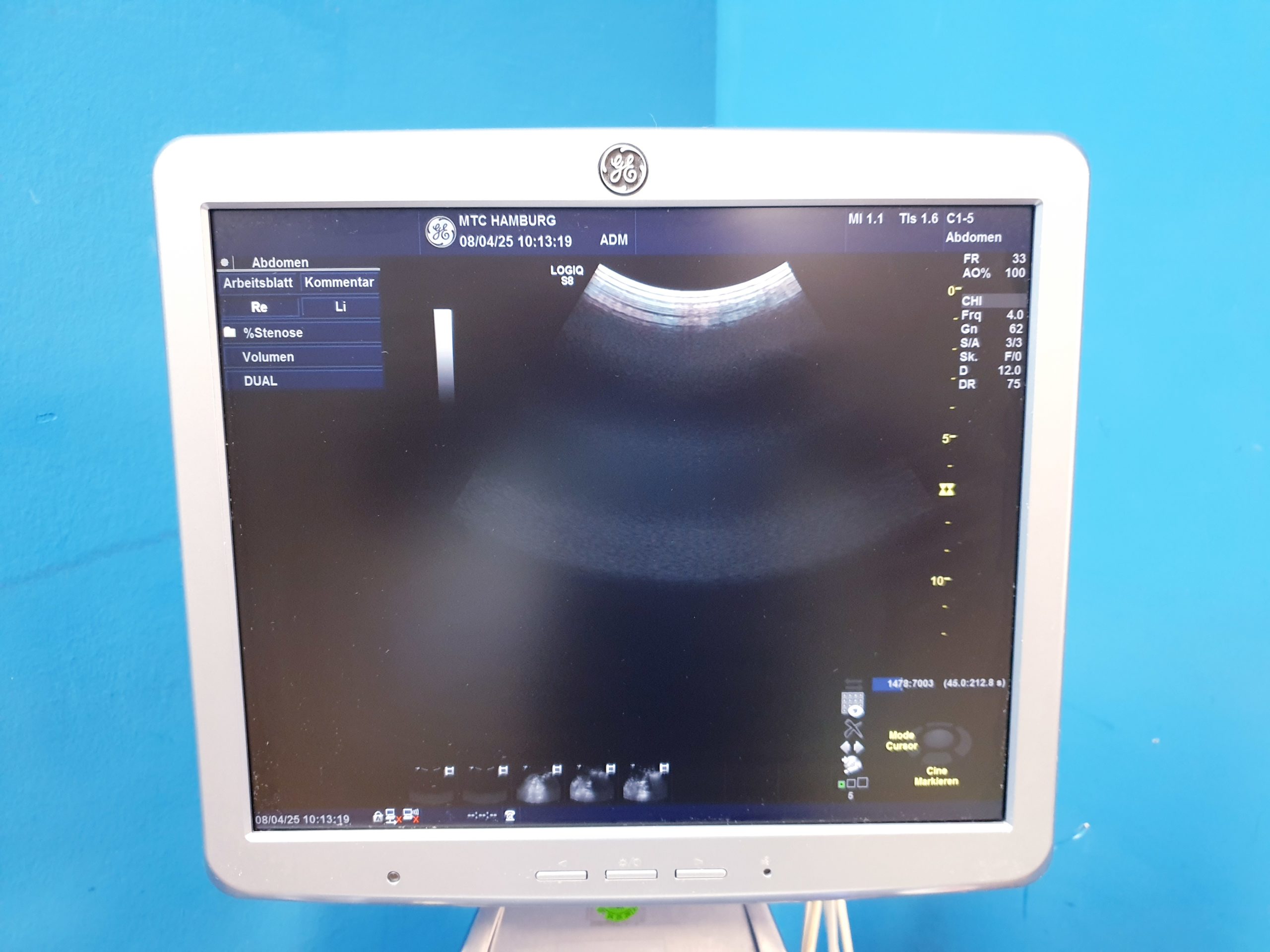 GE Logiq S8 + ML6-15 Linear + MS5-D Echo + C1-5 Konvex – Bild 18