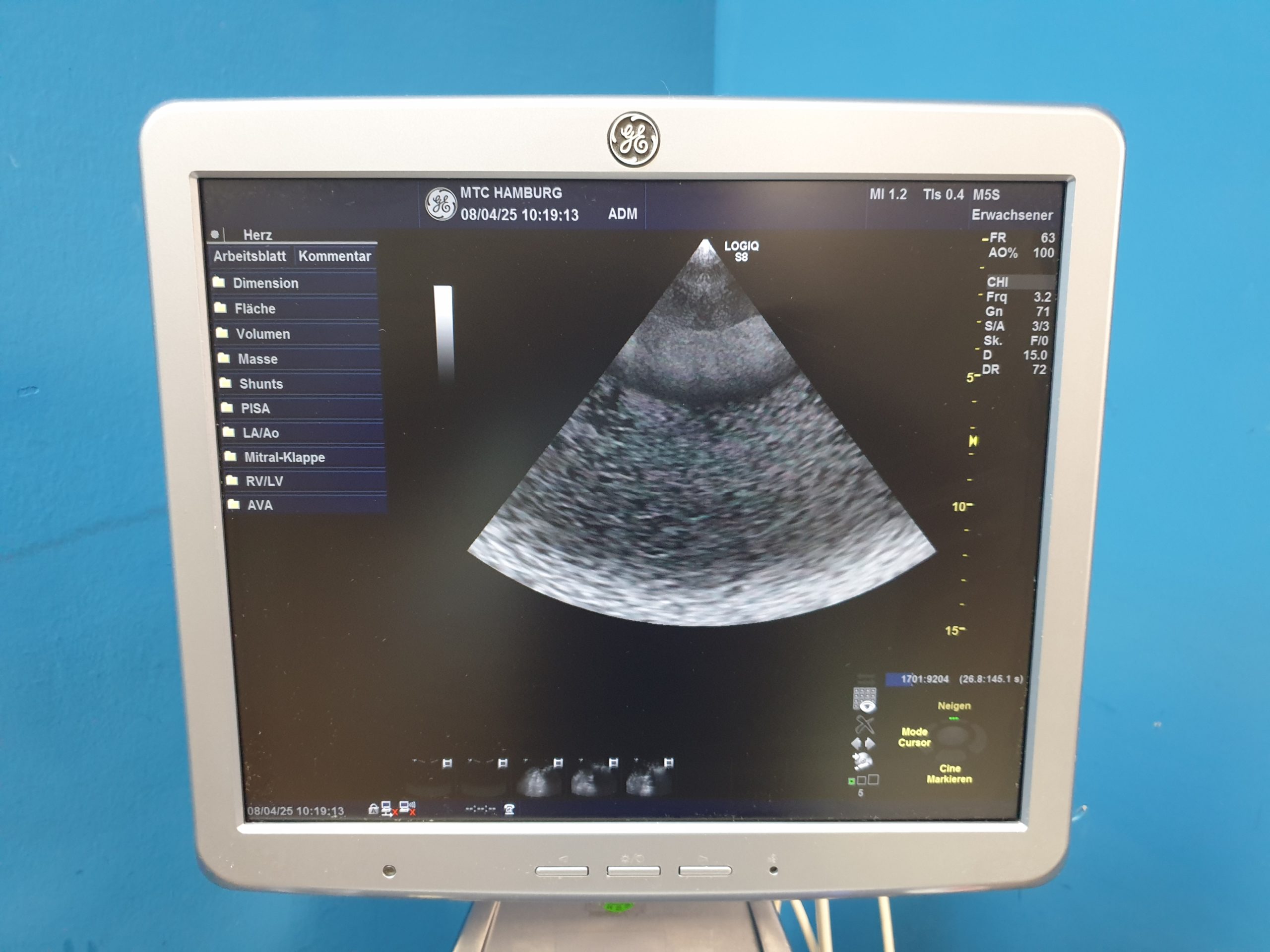 GE Logiq S8 + ML6-15 Linear + MS5-D Echo + C1-5 Konvex – Bild 22