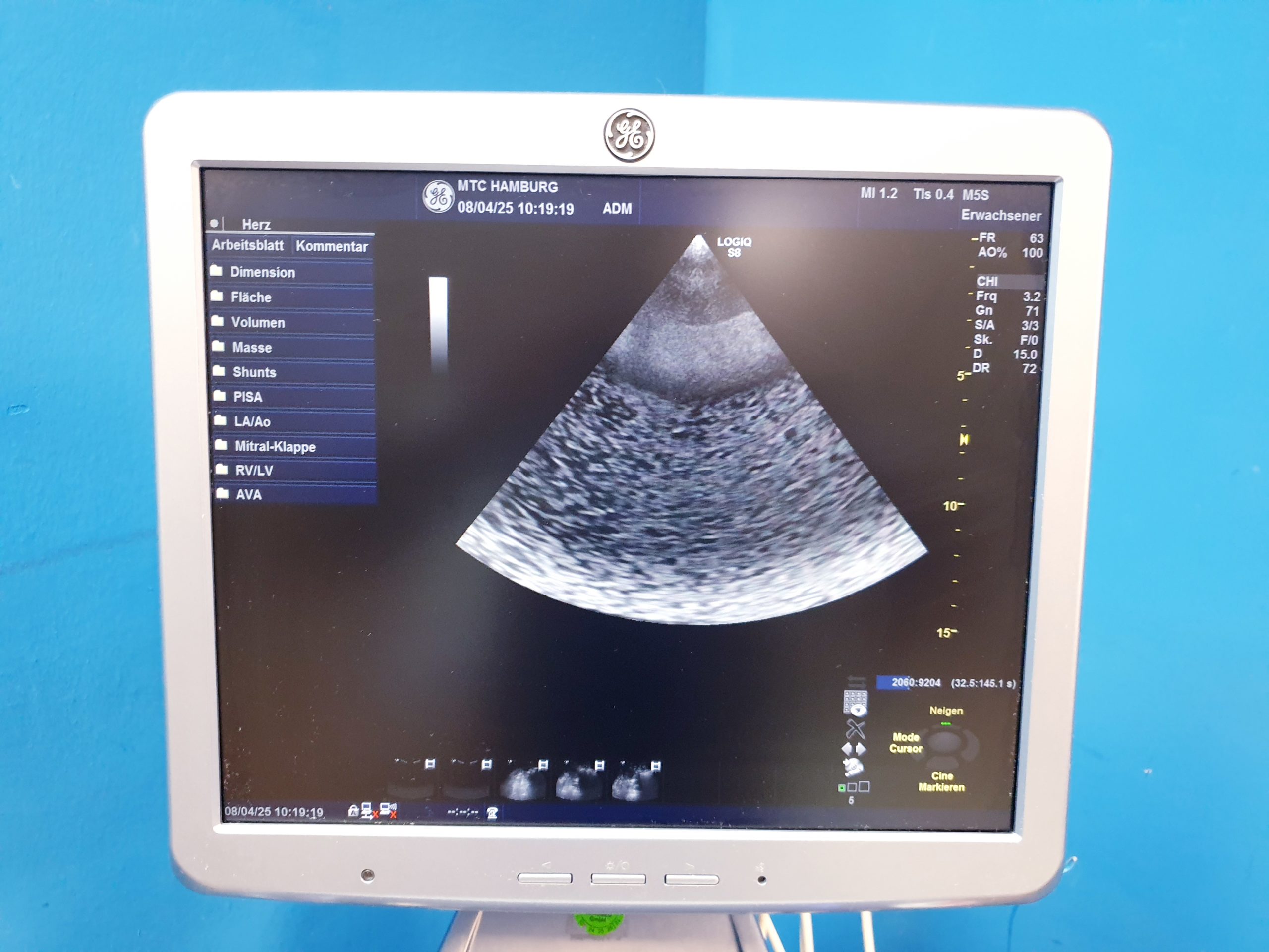 GE Logiq S8 + ML6-15 Linear + MS5-D Echo + C1-5 Konvex – Bild 23