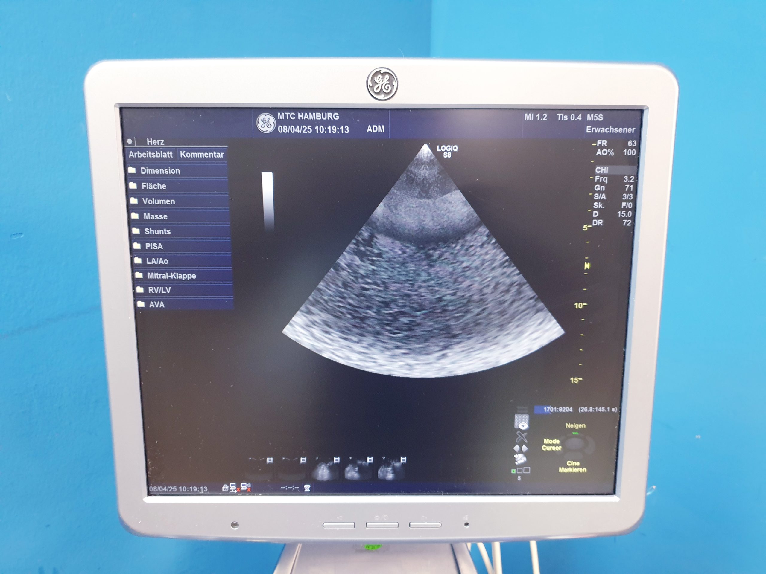 GE Logiq S8 + ML6-15 Linear + MS5-D Echo + C1-5 Konvex – Bild 29