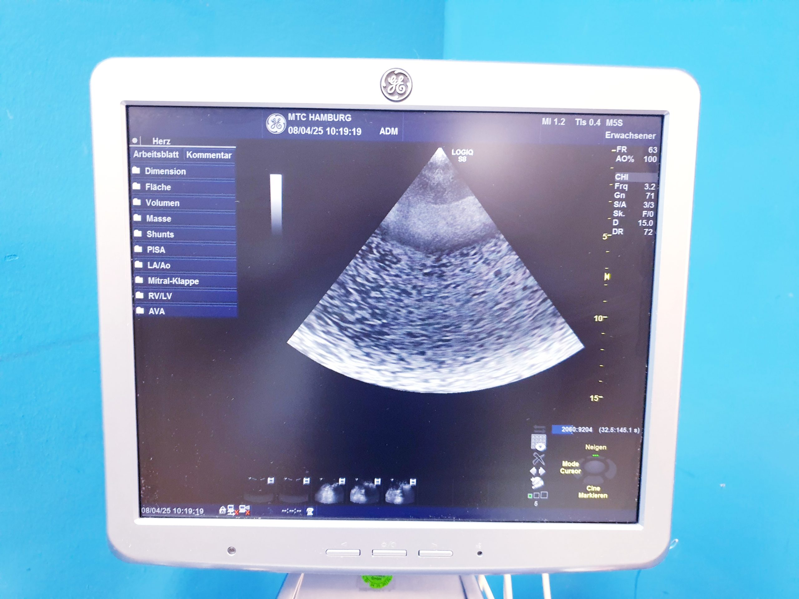 GE Logiq S8 + ML6-15 Linear + MS5-D Echo + C1-5 Konvex – Bild 33