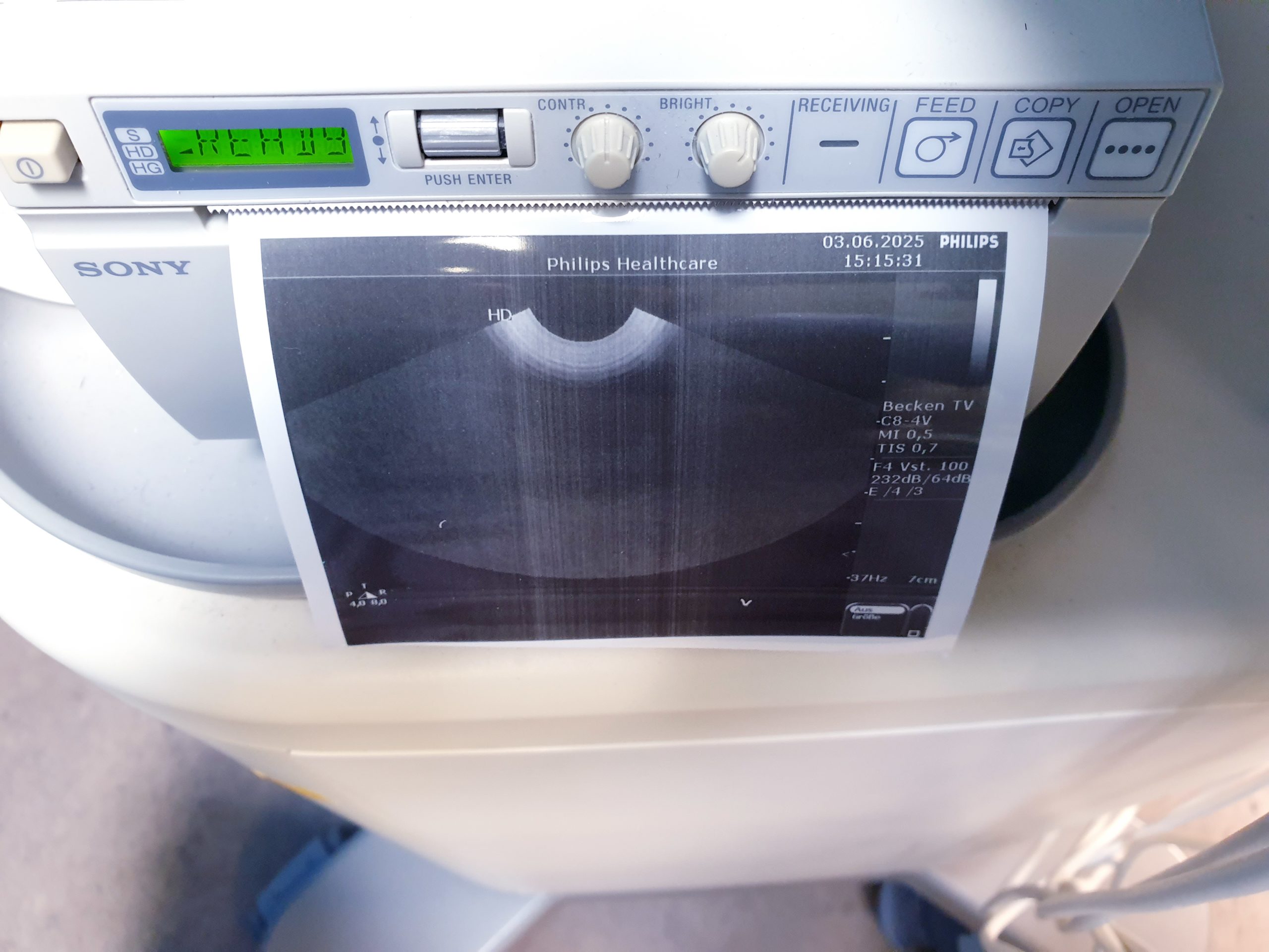 Philips HD 5 HD5 + C5-2 + C8-4v + L12-3 – Gynmaschine Farbdoppler – Bild 9